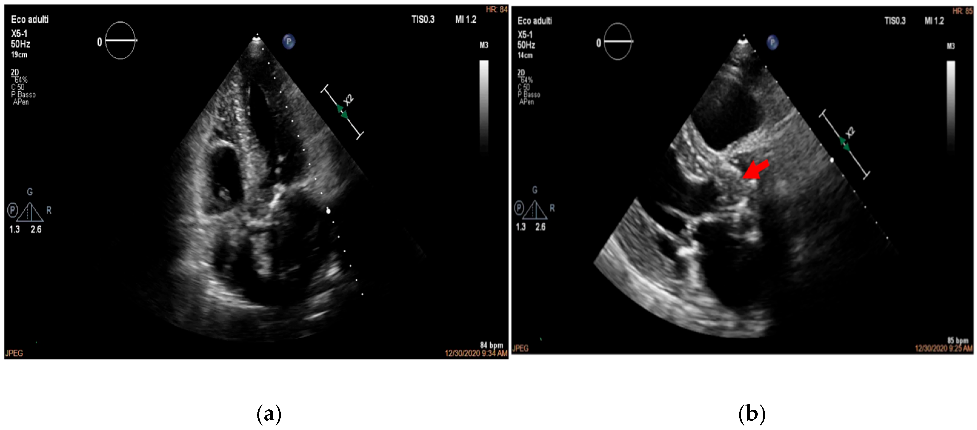 Medicina 61 02241 g002