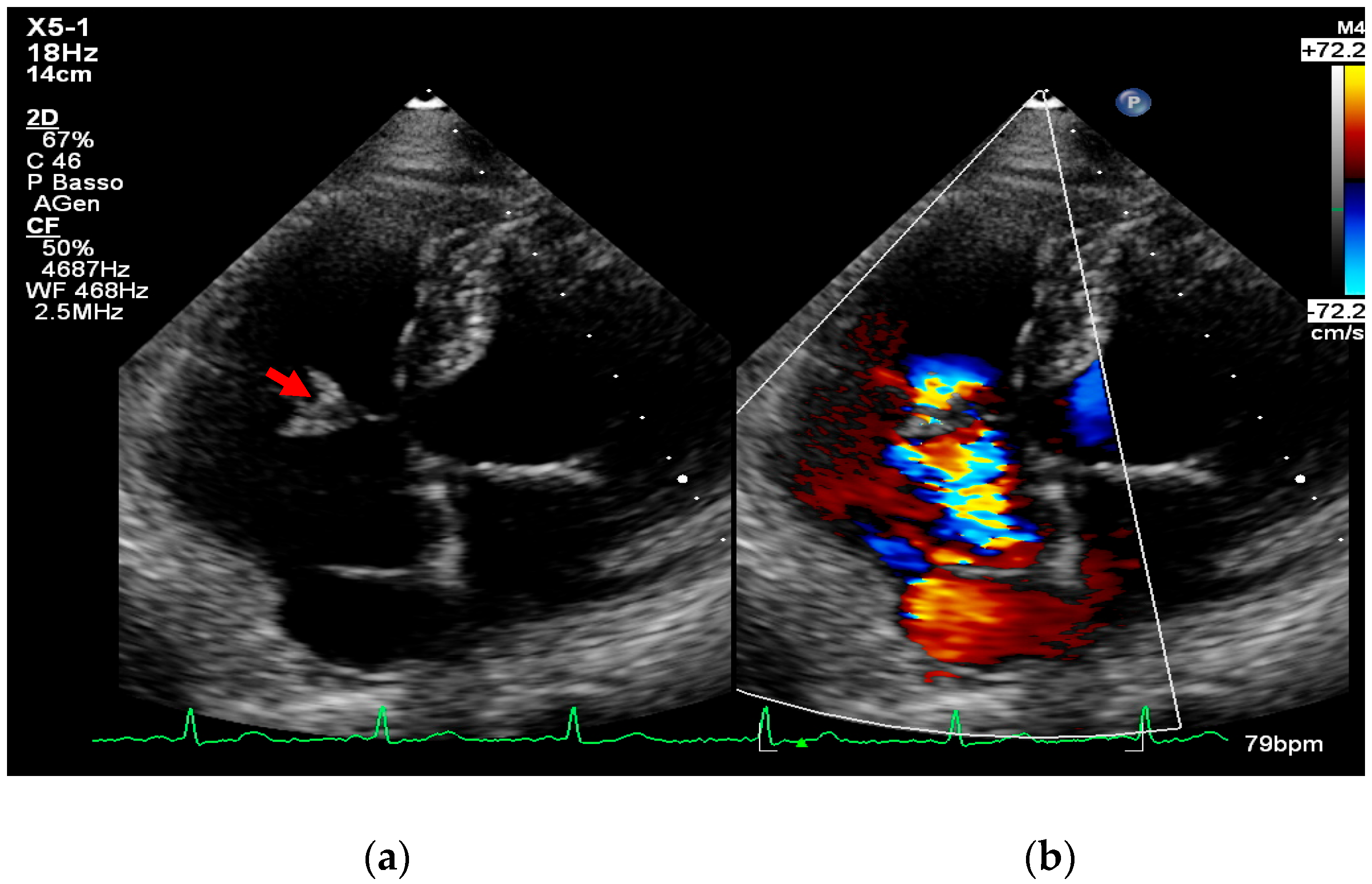 Medicina 61 02241 g004
