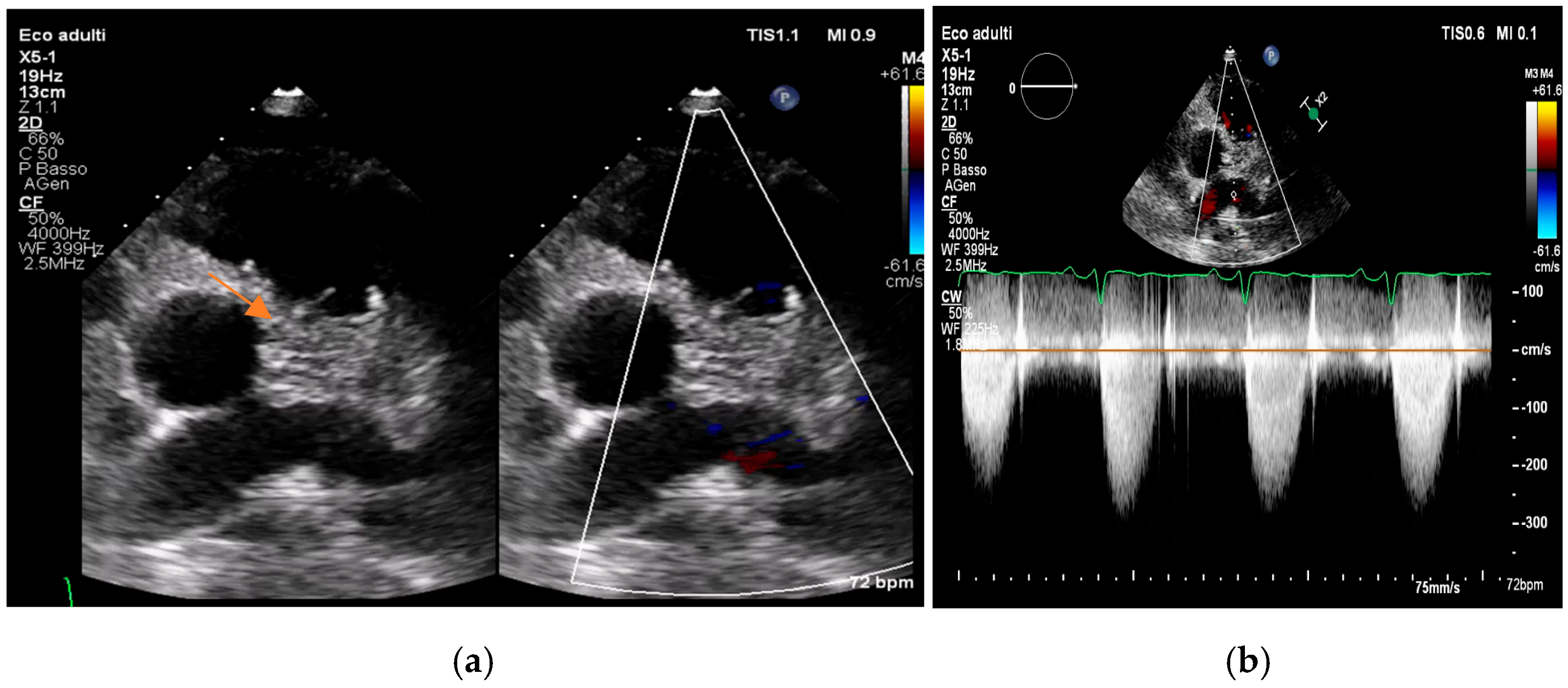 Medicina 61 02241 g005