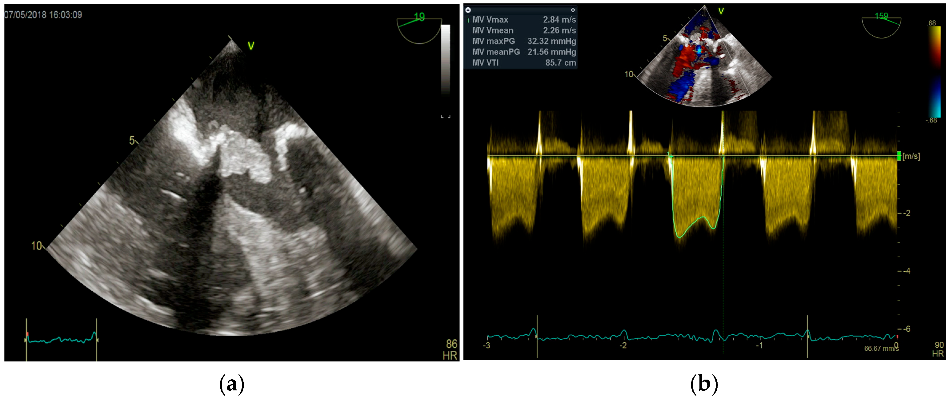 Medicina 61 02241 g006
