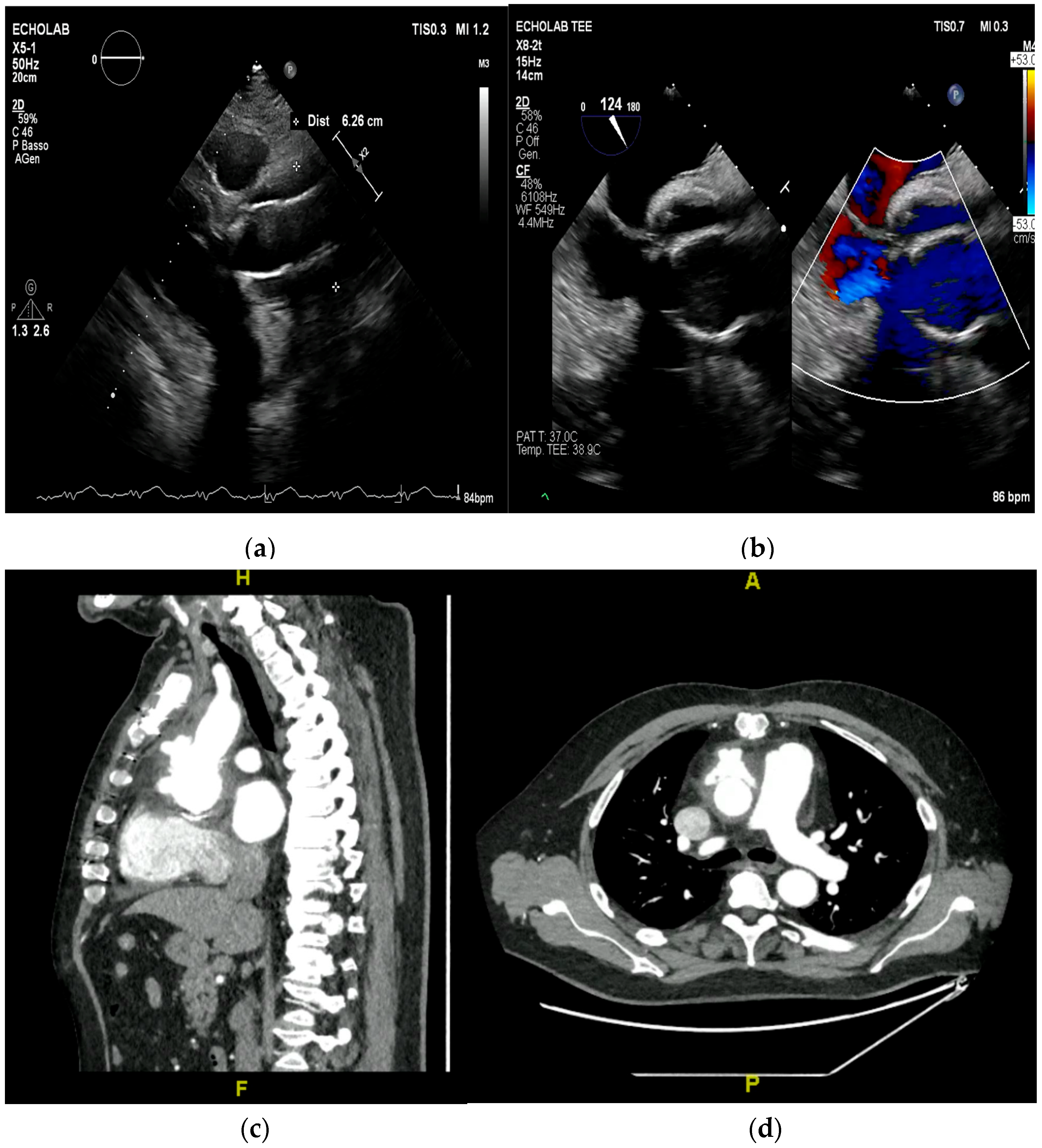 Medicina 61 02241 g014