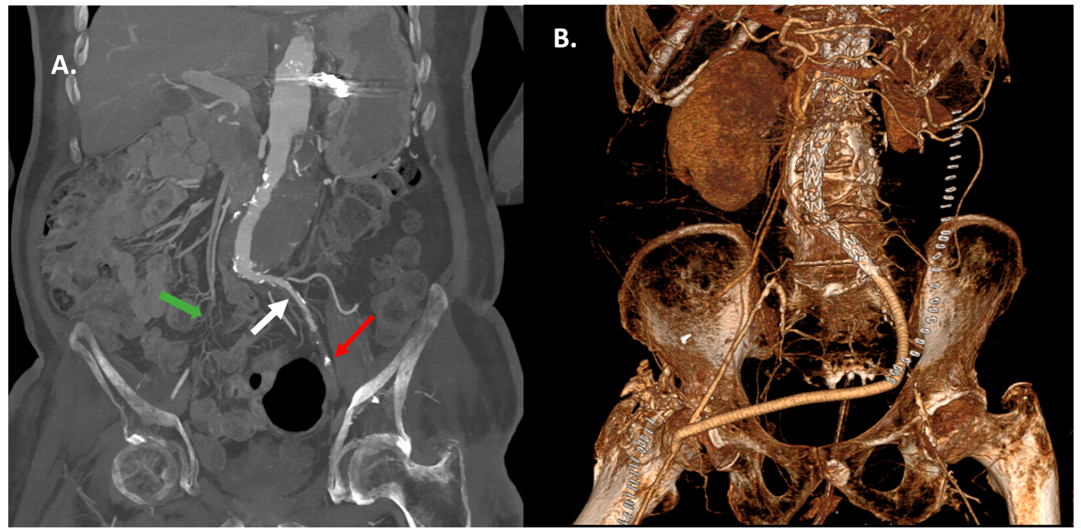 Medicina 62 00017 g002 Medicina 62 00017 g002