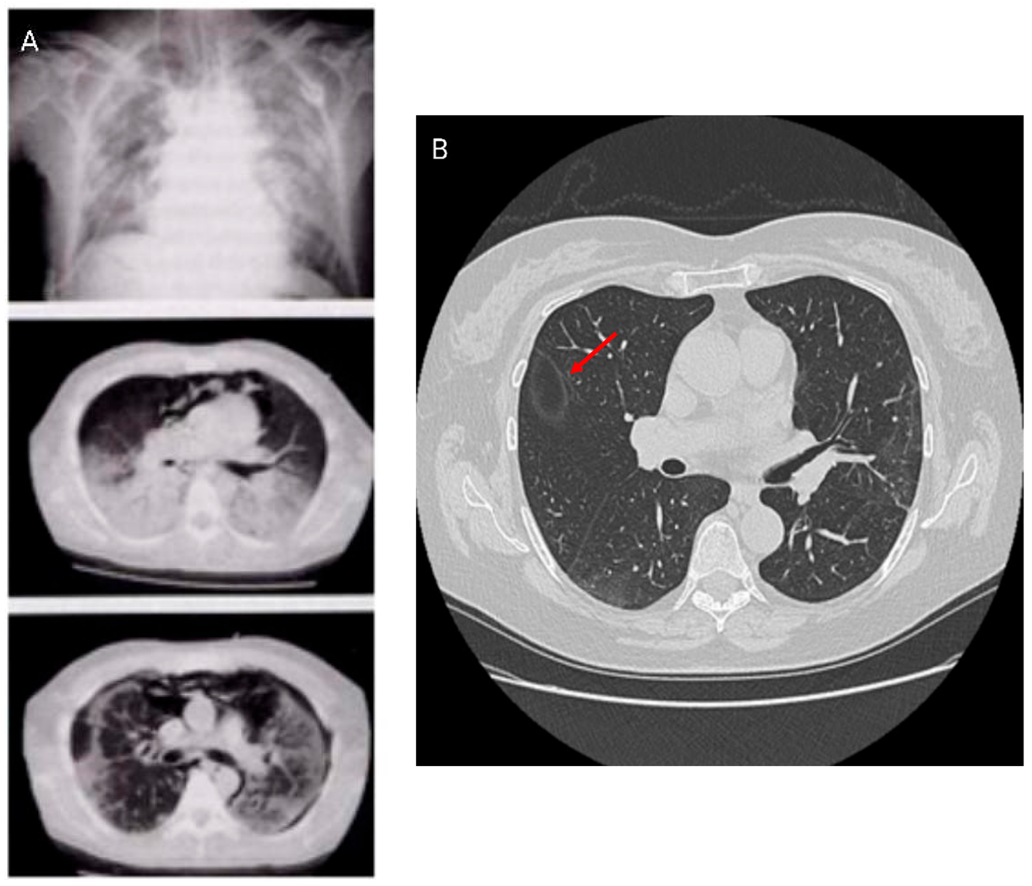 Medicina 62 00022 g003