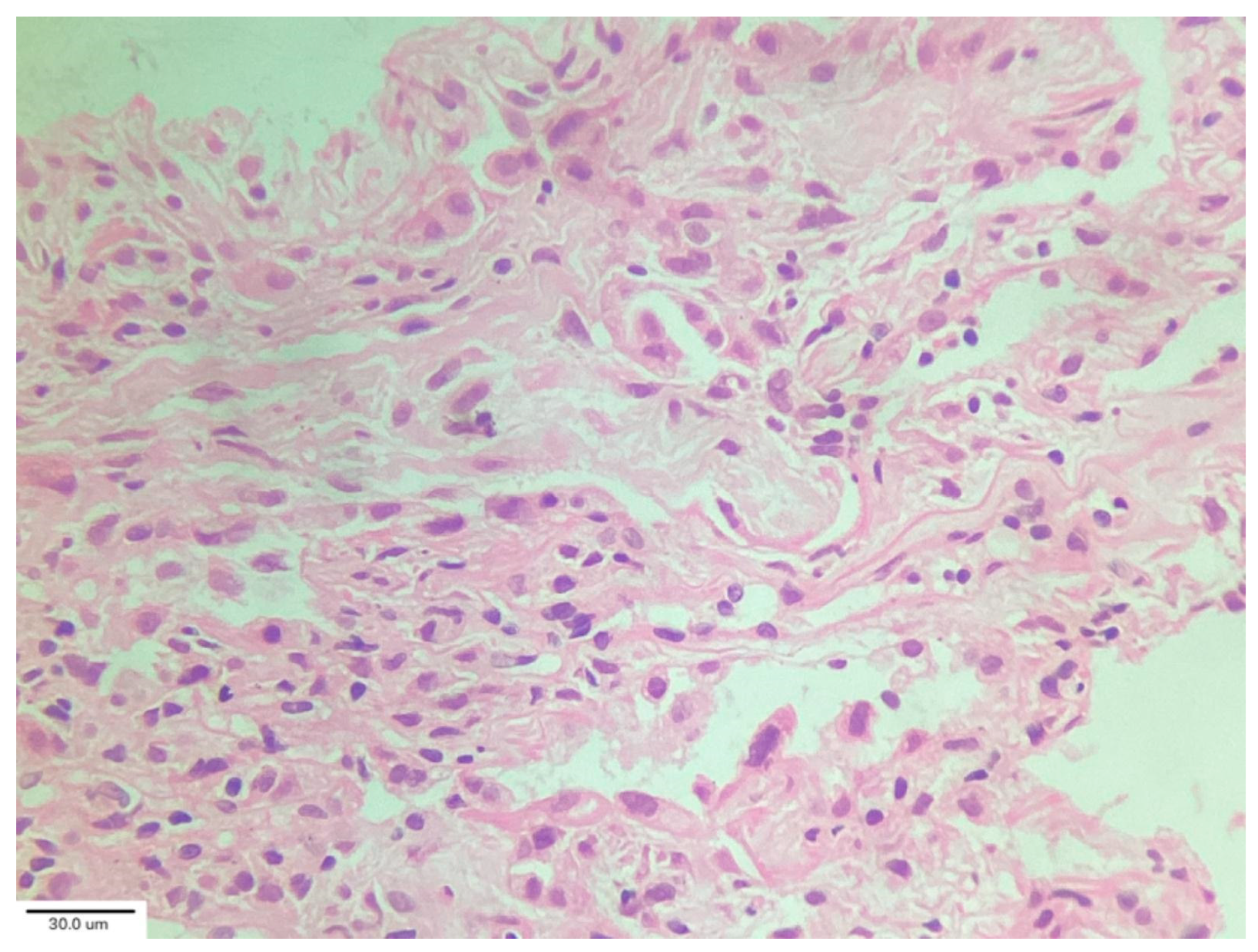 Medicina 62 00022 g005