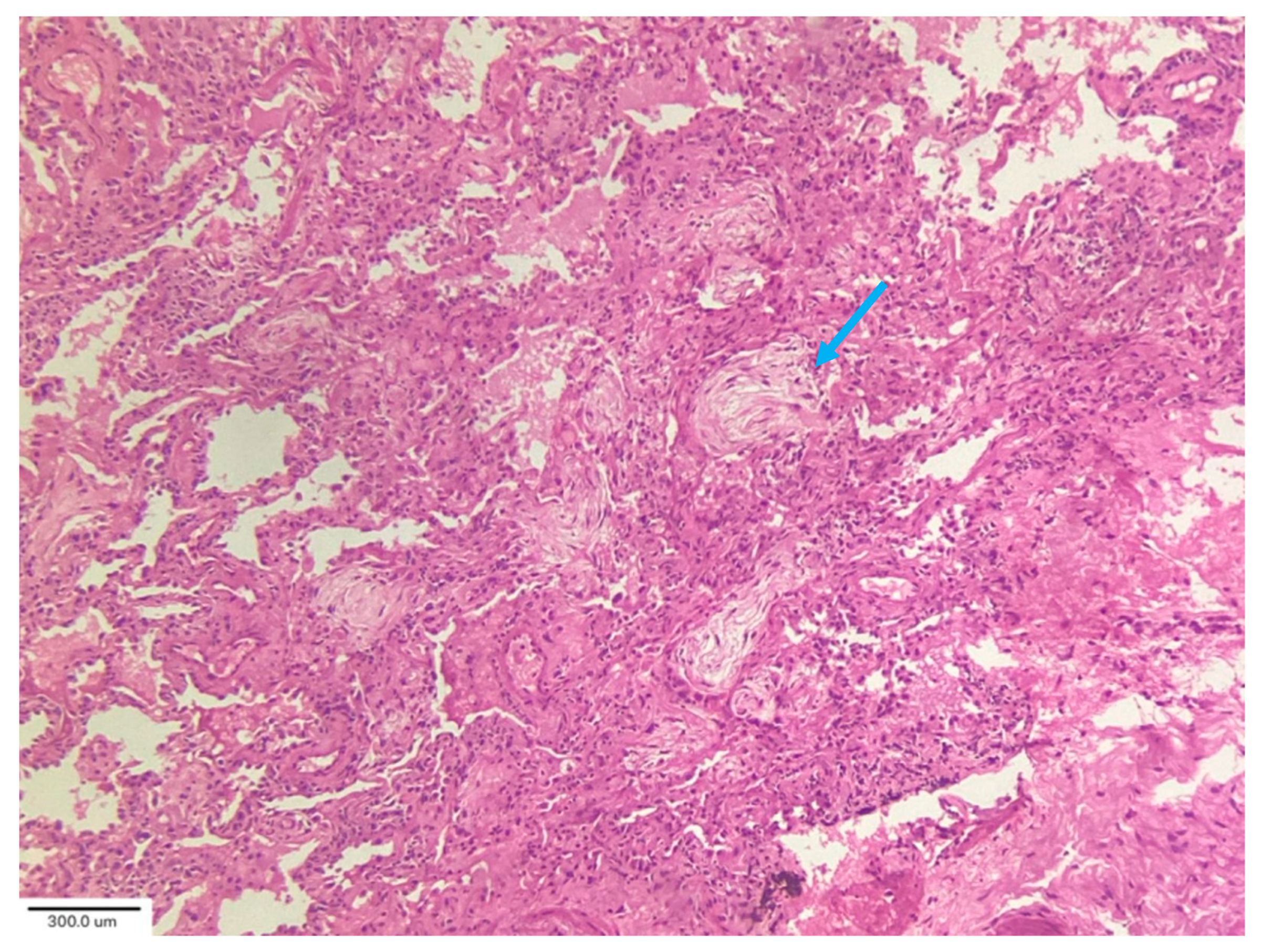 Medicina 62 00022 g006