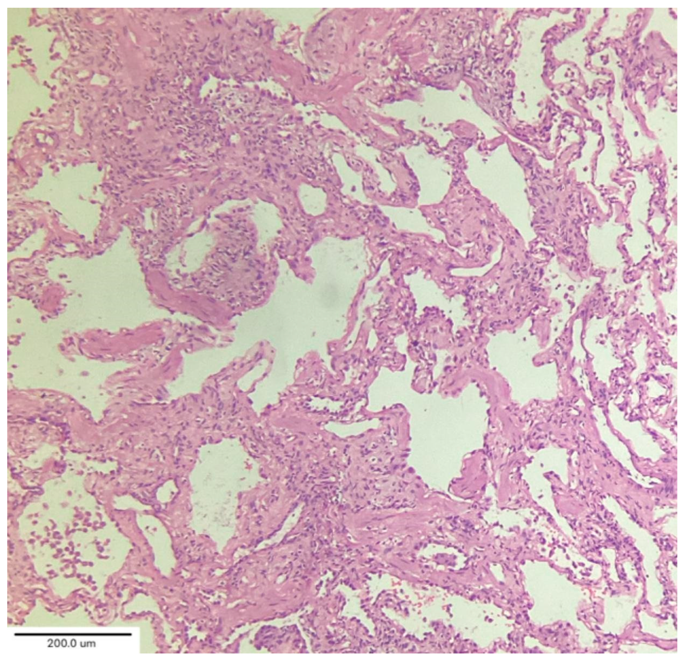 Medicina 62 00022 g007