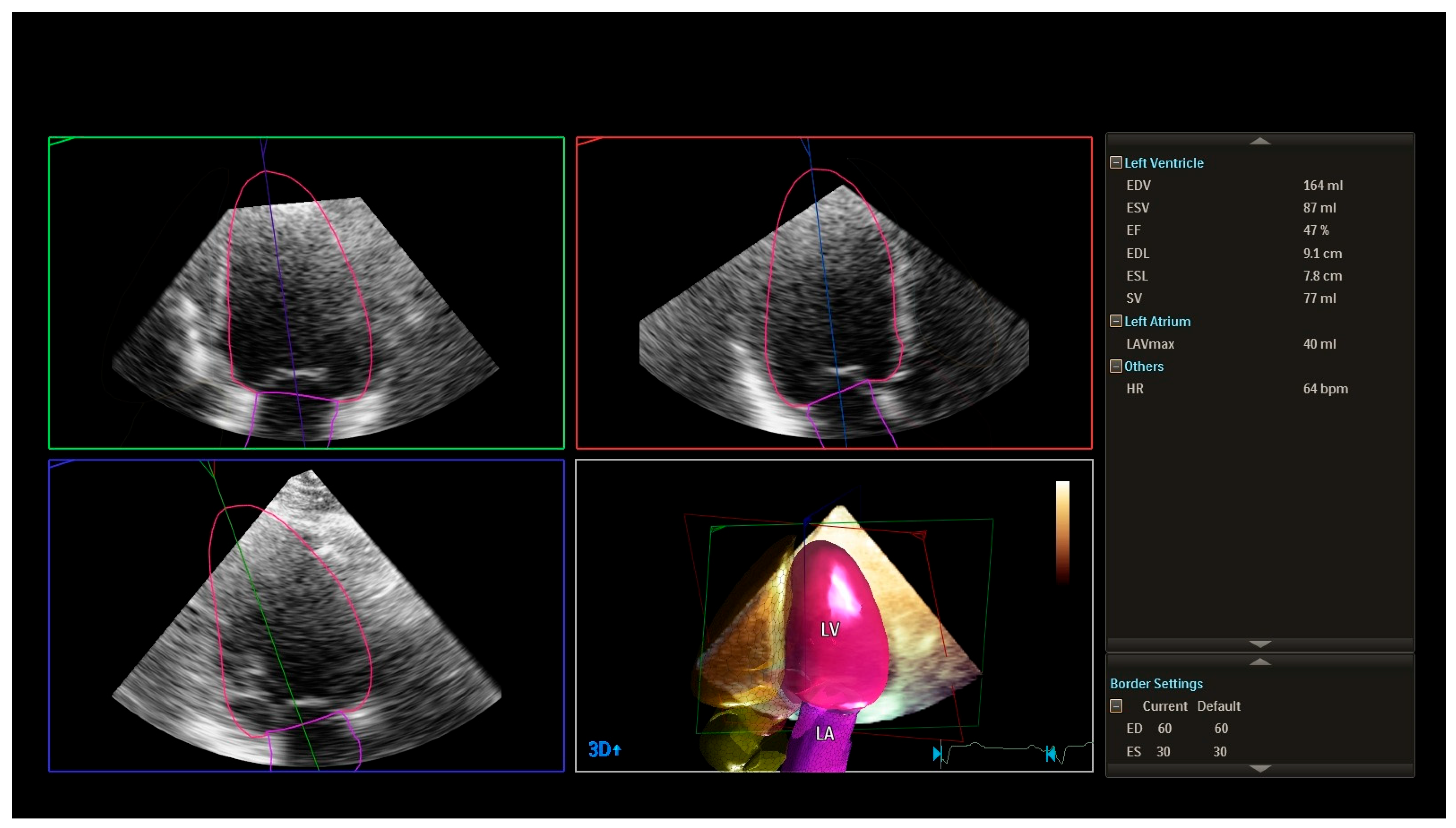 Medicina 62 00032 g001