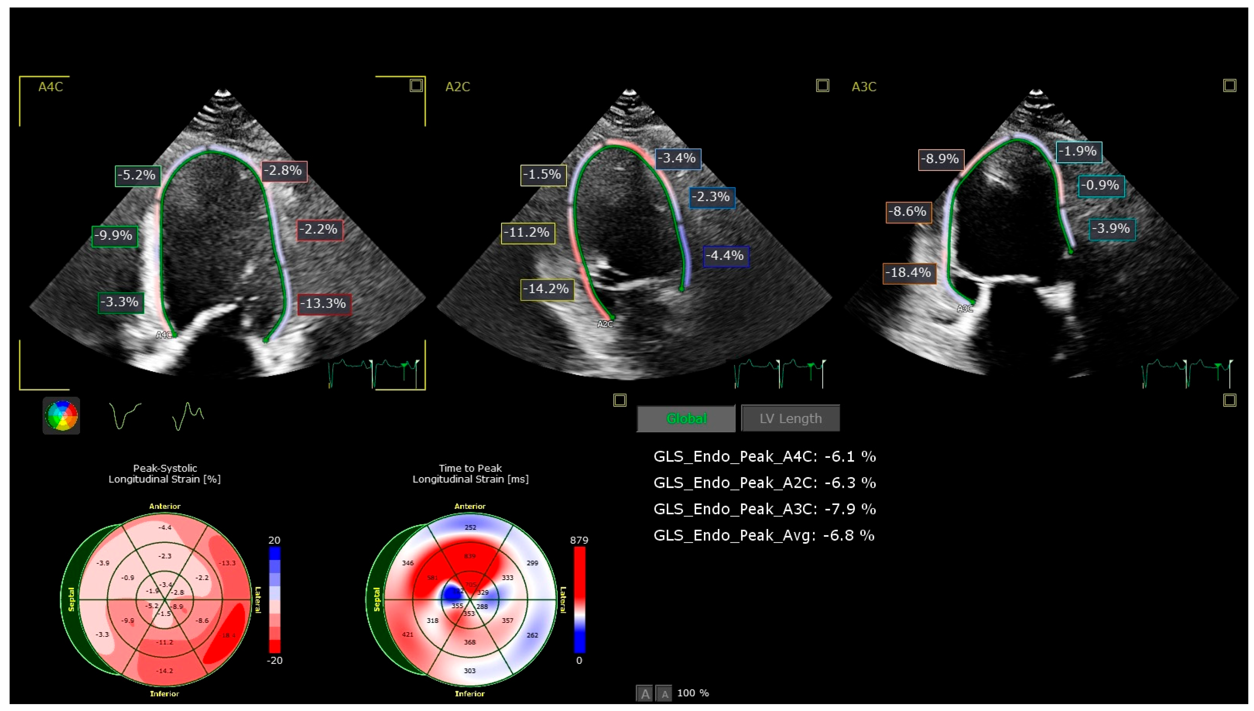 Medicina 62 00032 g002