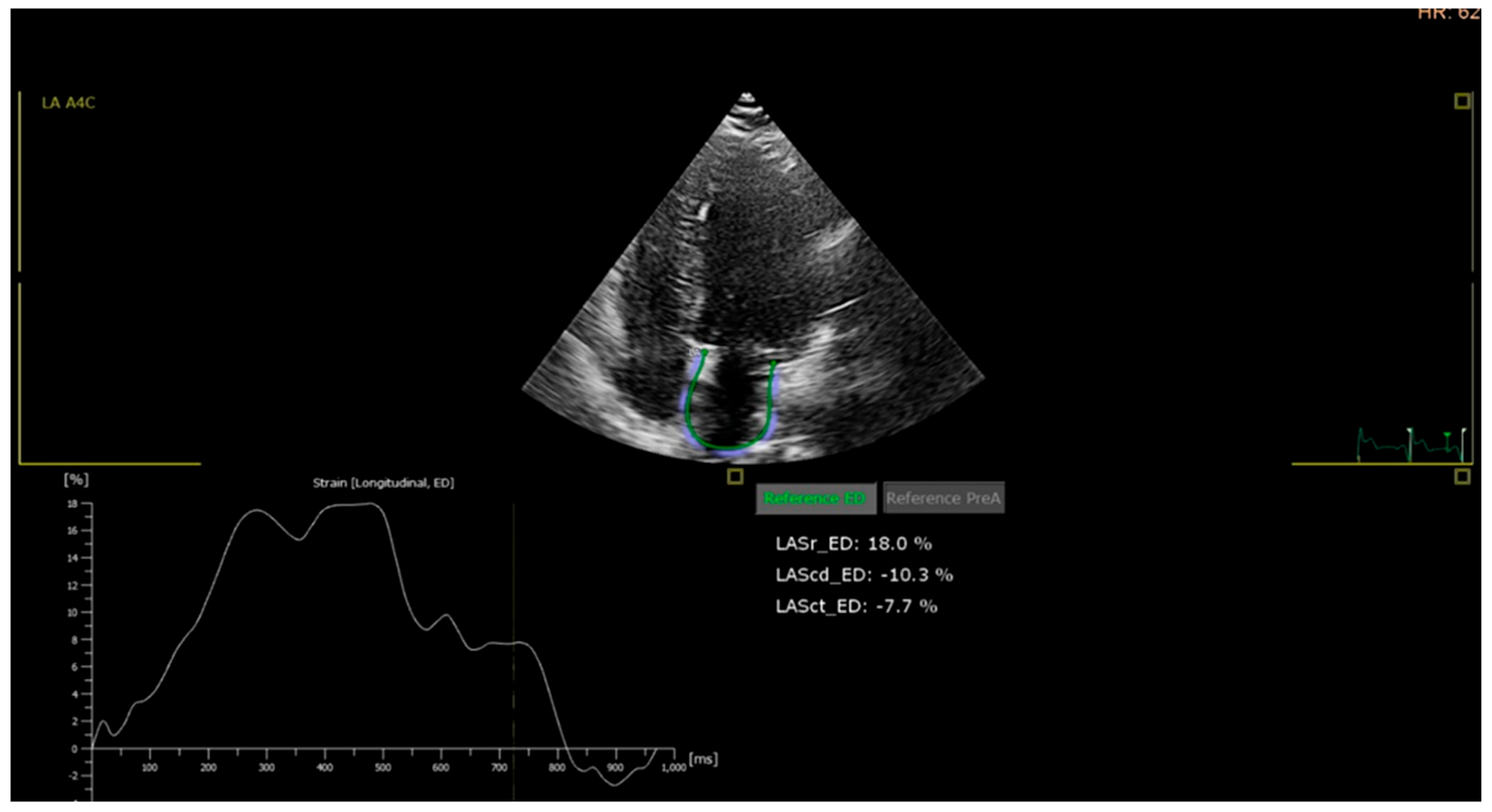 Medicina 62 00032 g003