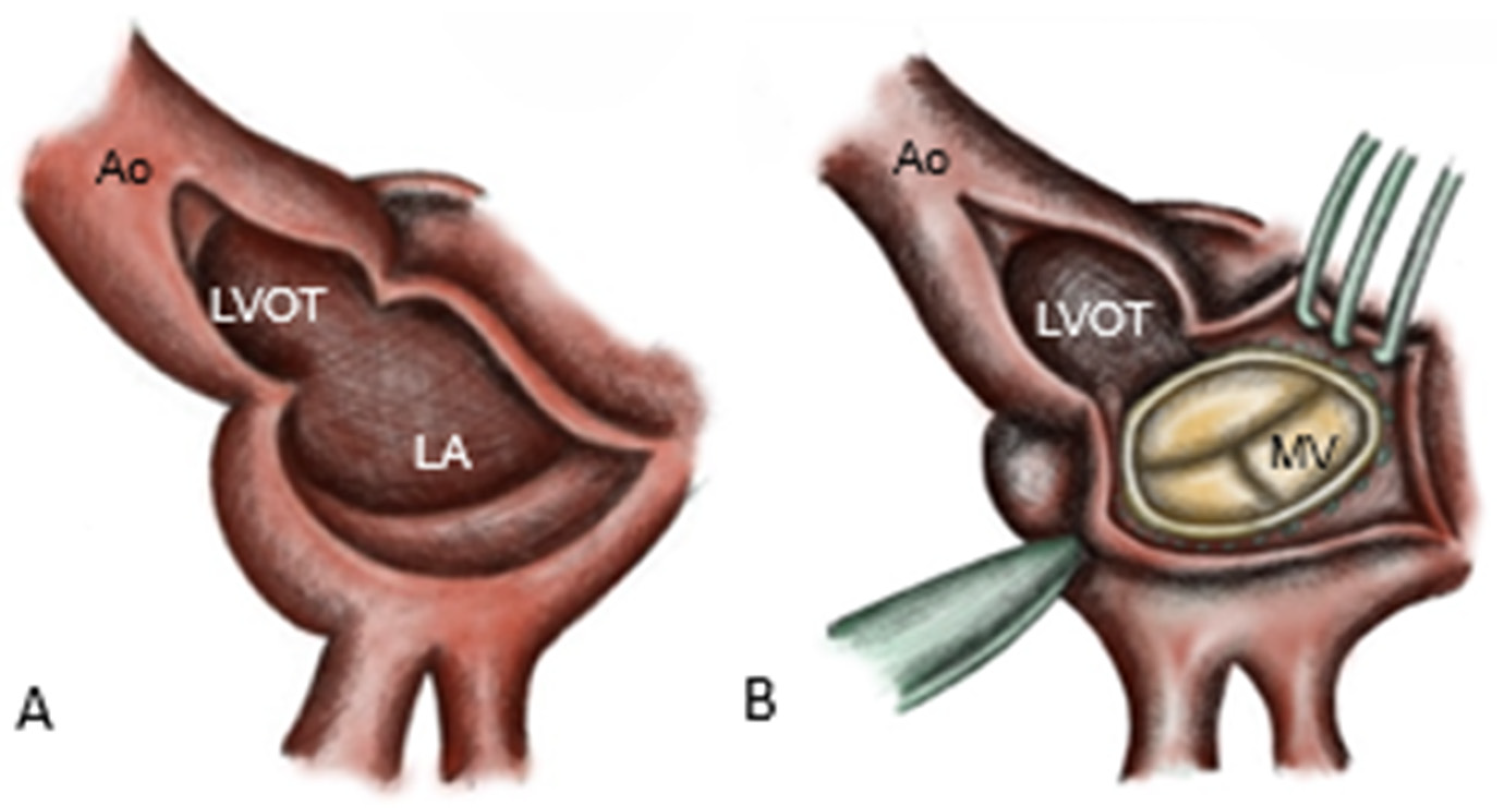 Medicina 62 00033 g002