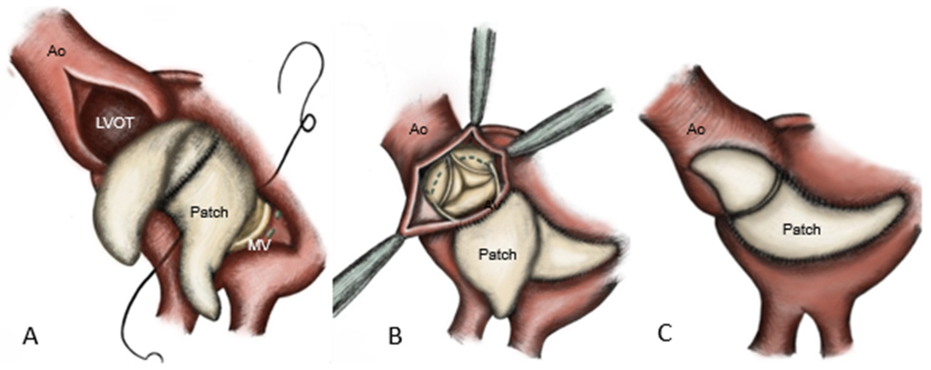 Medicina 62 00033 g003