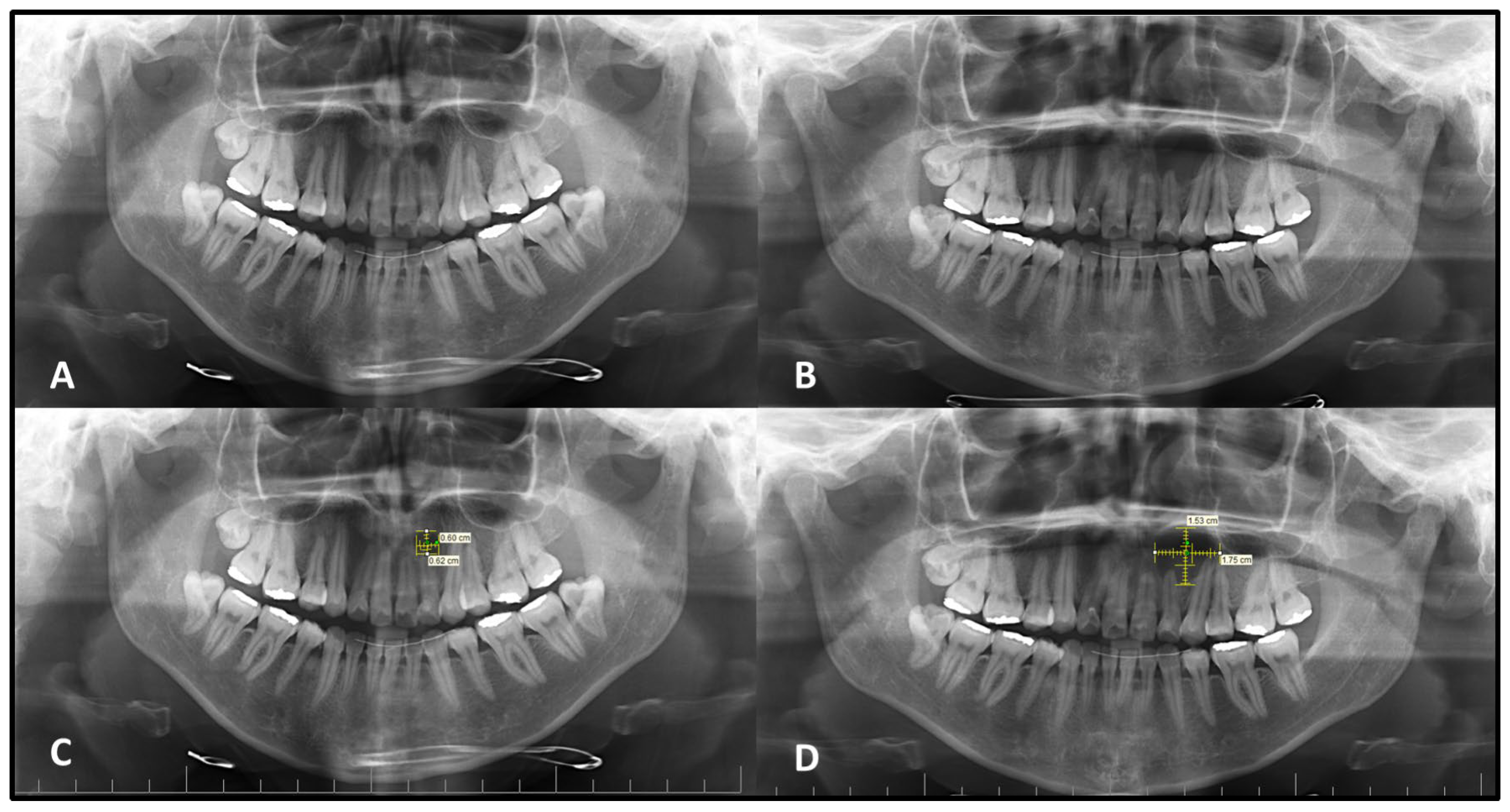 Medicina 62 00034 g001