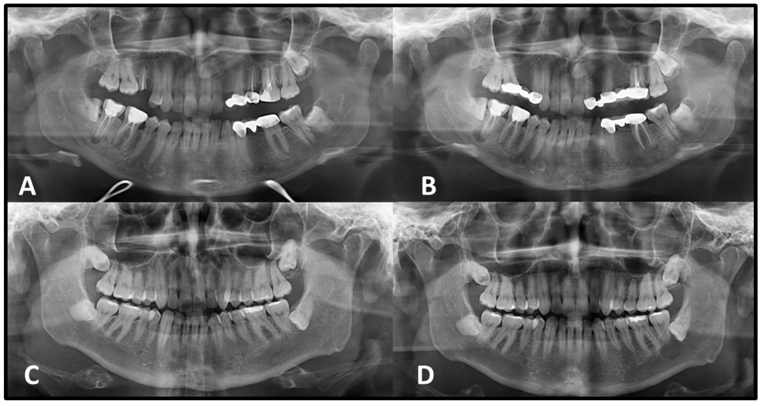 Medicina 62 00034 g002