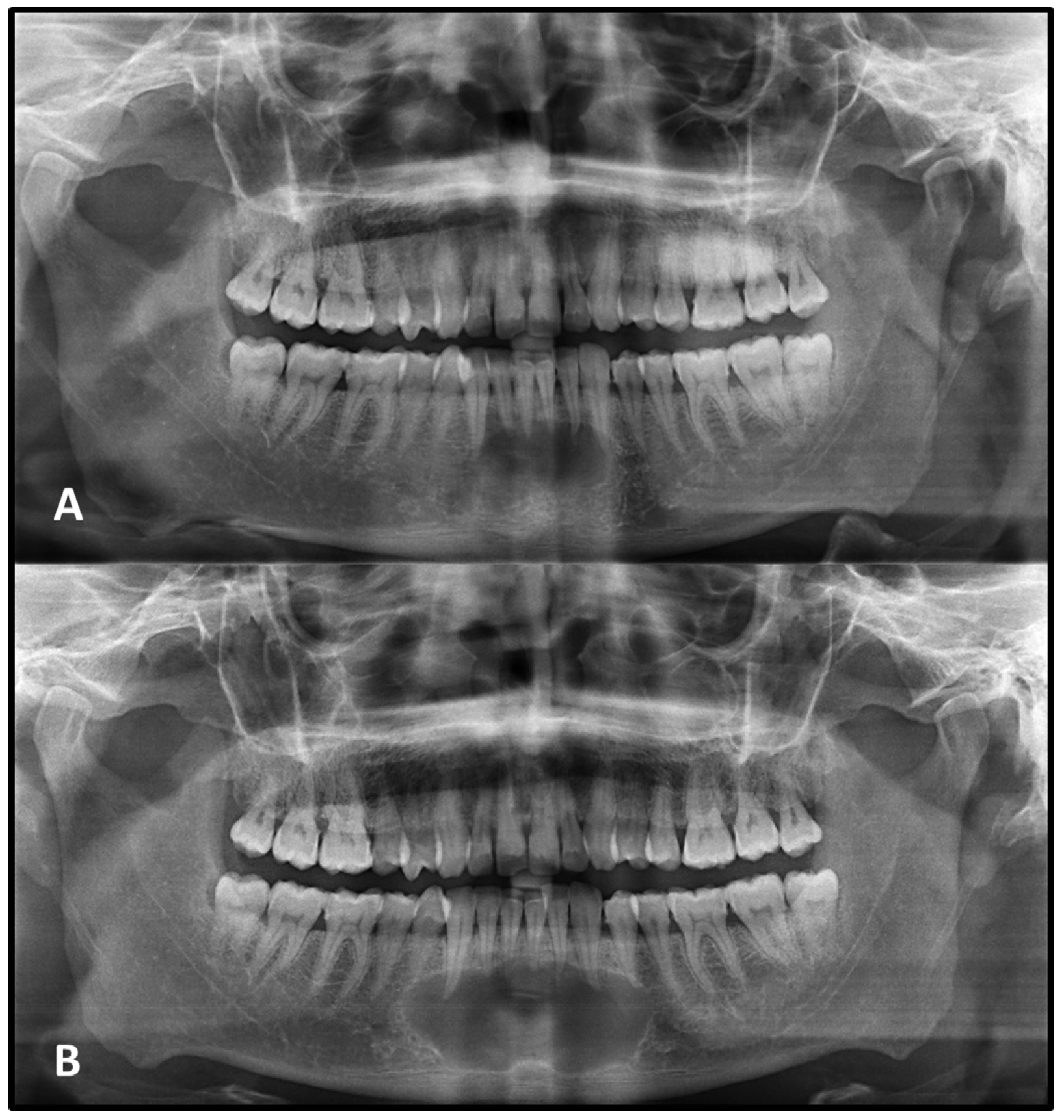 Medicina 62 00034 g003