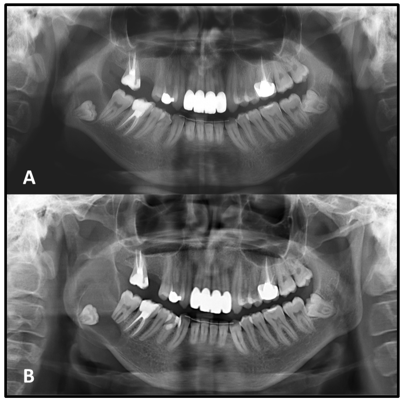 Medicina 62 00034 g004