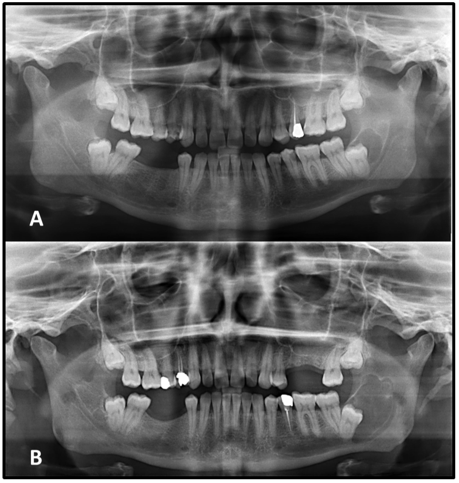 Medicina 62 00034 g005
