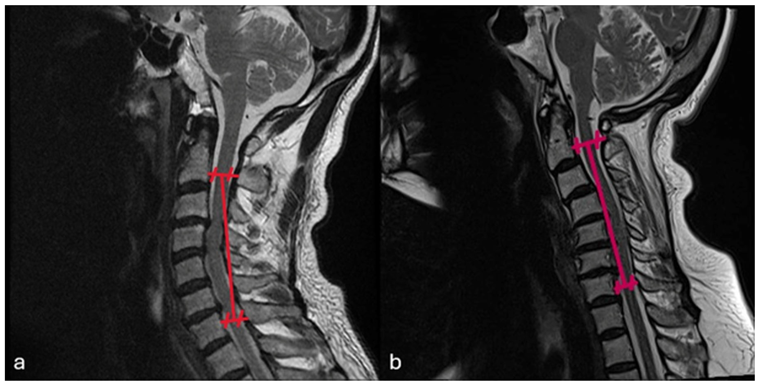 Medicina 62 00058 g005 Medicina 62 00058 g005