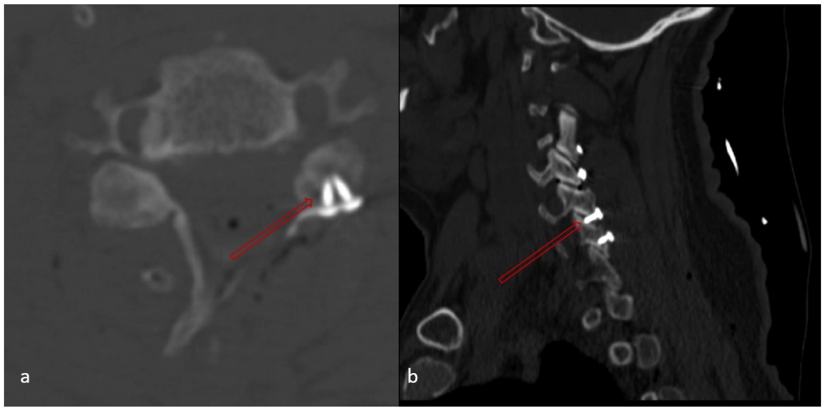 Medicina 62 00058 g006 Medicina 62 00058 g006