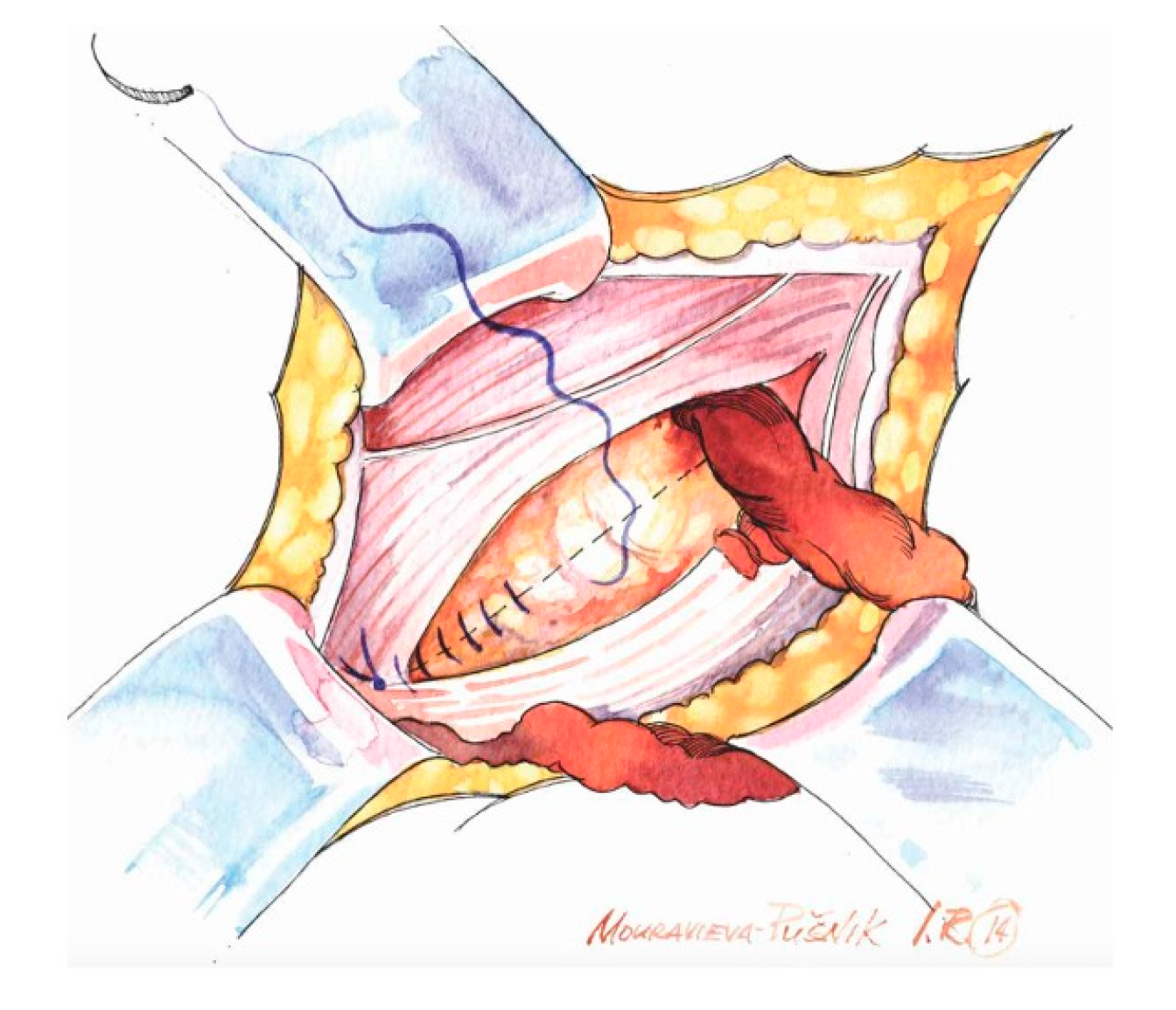 Medicina 62 00079 g001 Medicina 62 00079 g001