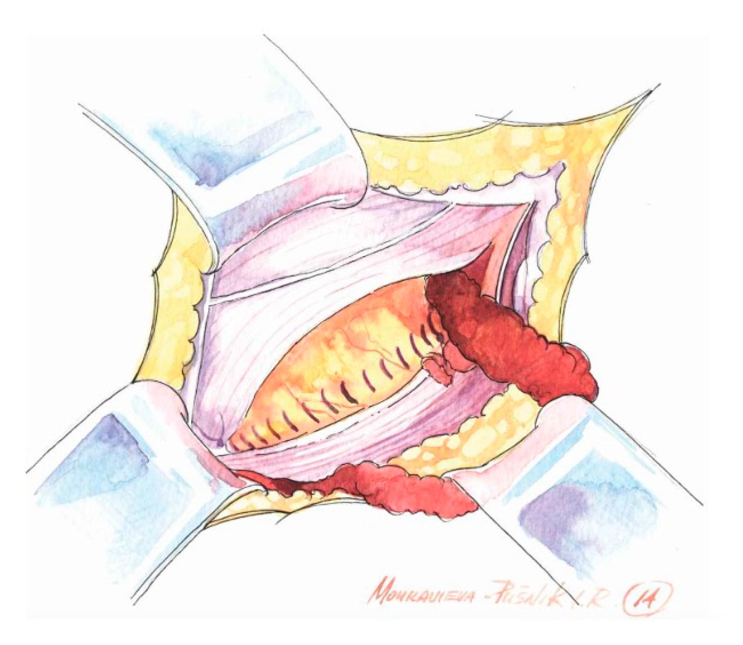 Medicina 62 00079 g002 Medicina 62 00079 g002