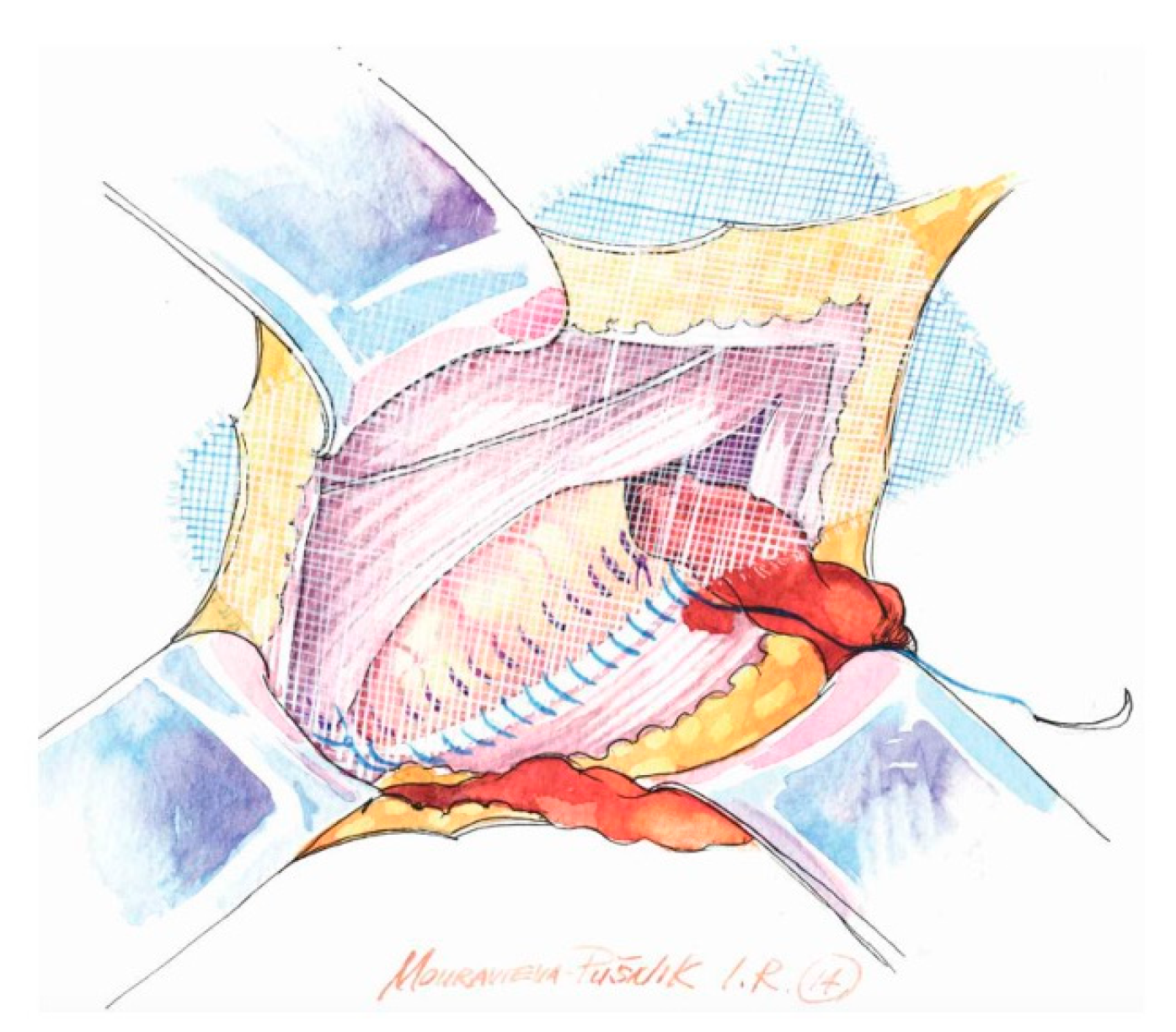 Medicina 62 00079 g003 Medicina 62 00079 g003