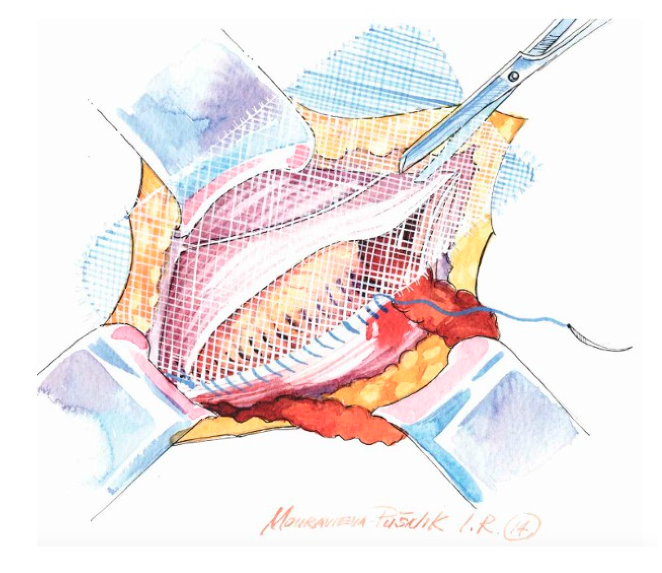 Medicina 62 00079 g004 Medicina 62 00079 g004