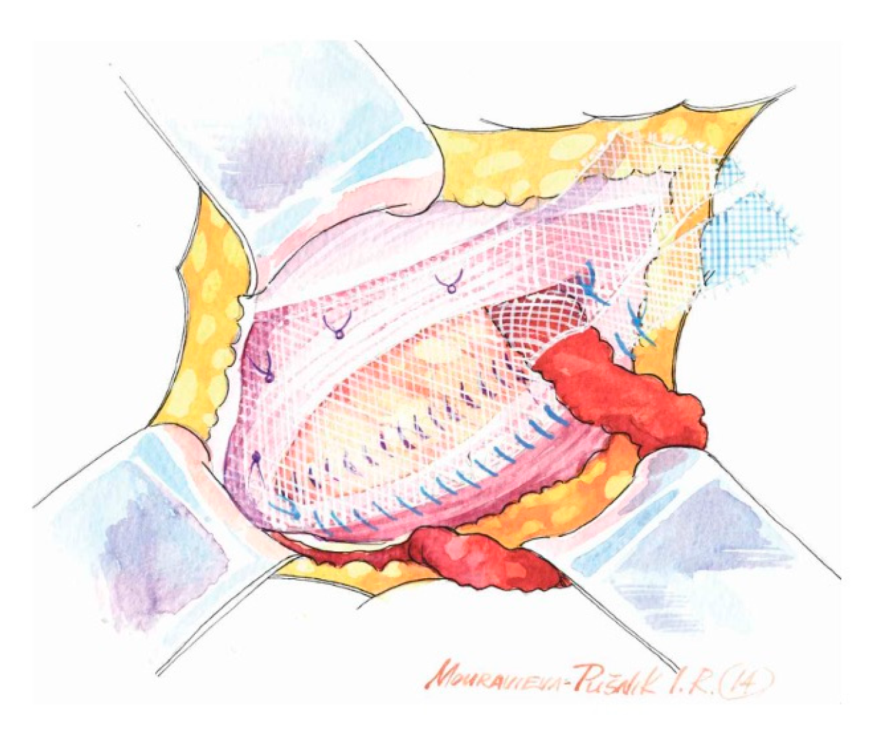 Medicina 62 00079 g005 Medicina 62 00079 g005