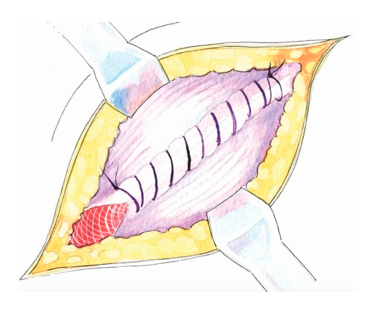 Medicina 62 00079 g006 Medicina 62 00079 g006