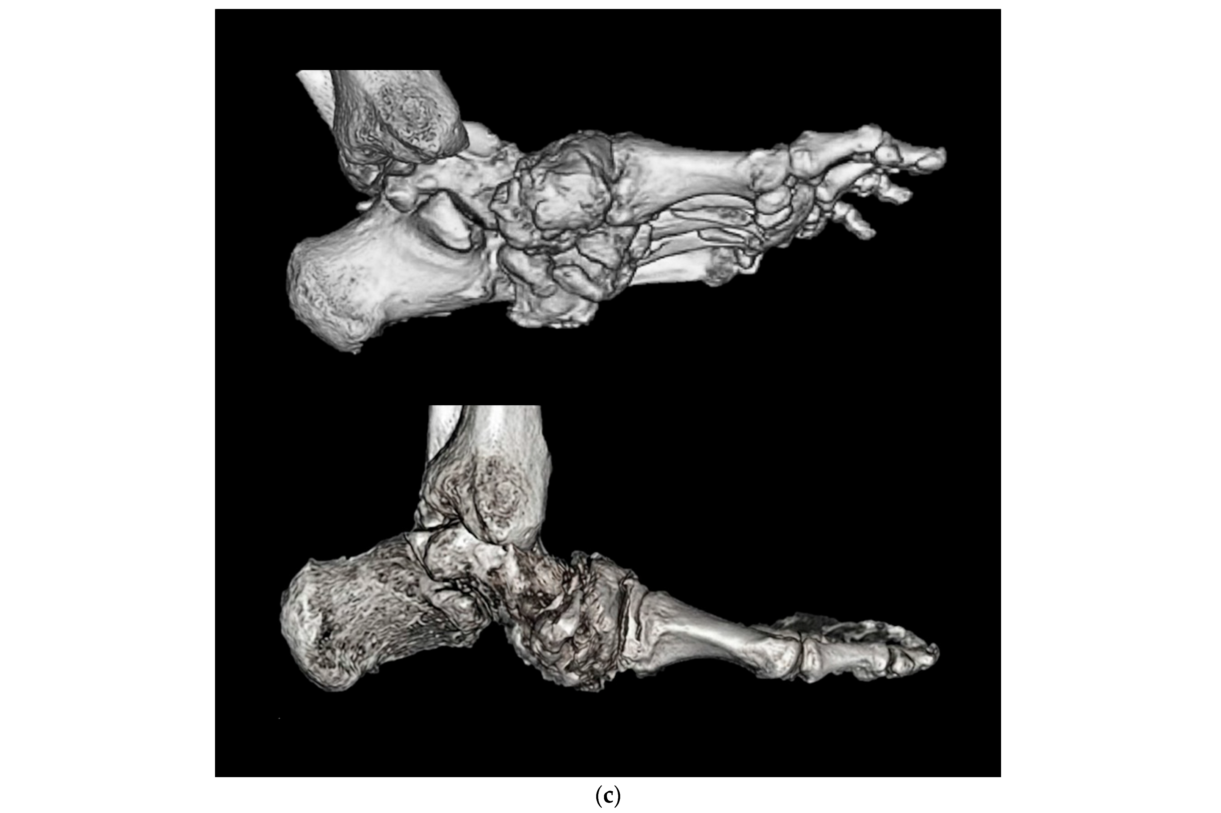 Medicina 62 00117 g001b