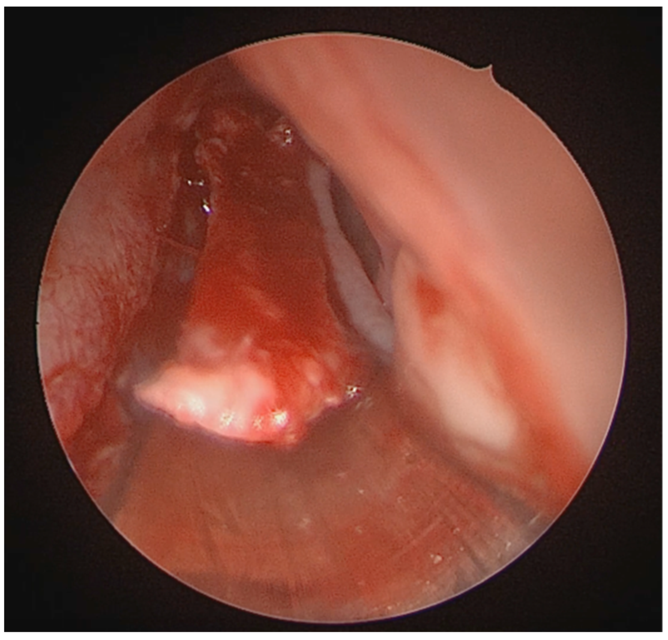 Medicina 62 00135 g003