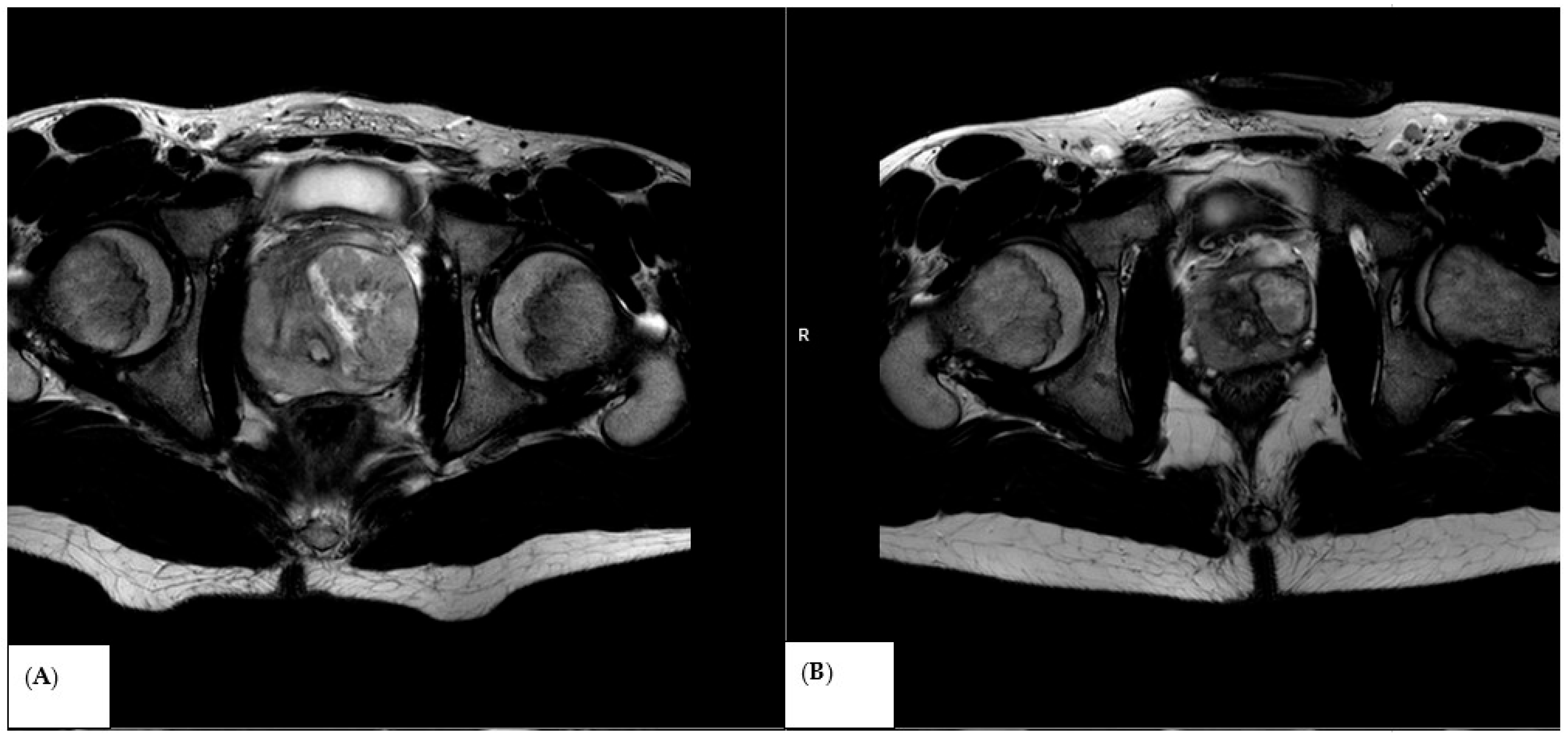 Medicina 62 00173 g004