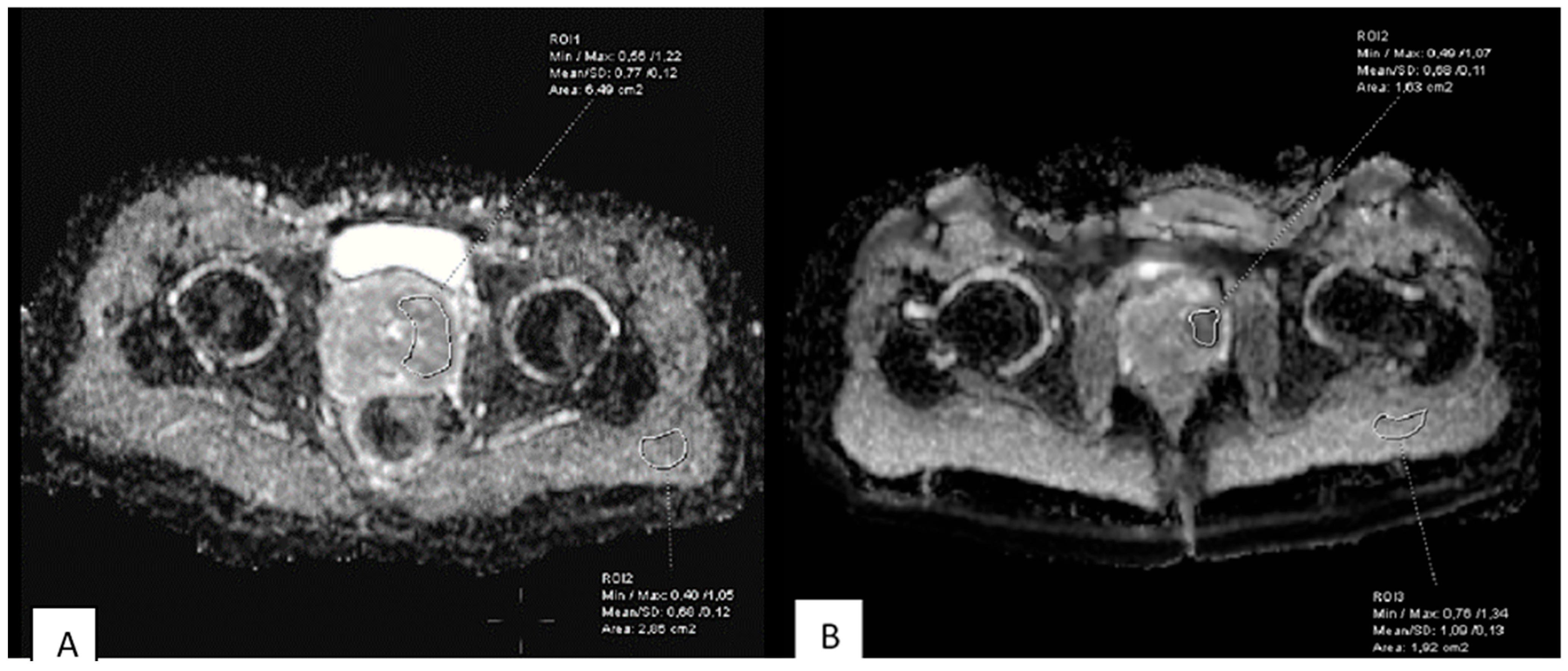 Medicina 62 00173 g005