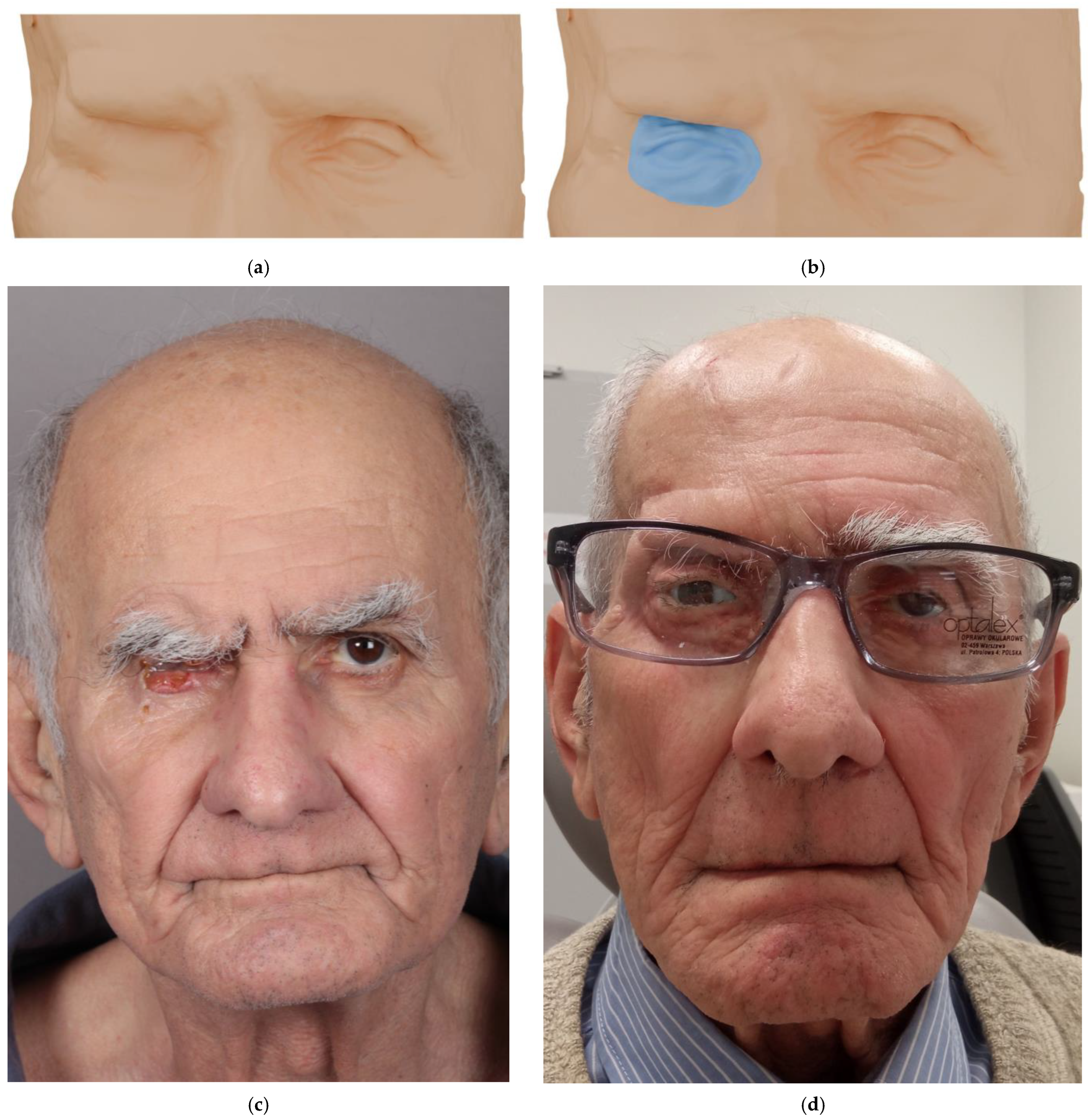 Medicina 62 00607 g004