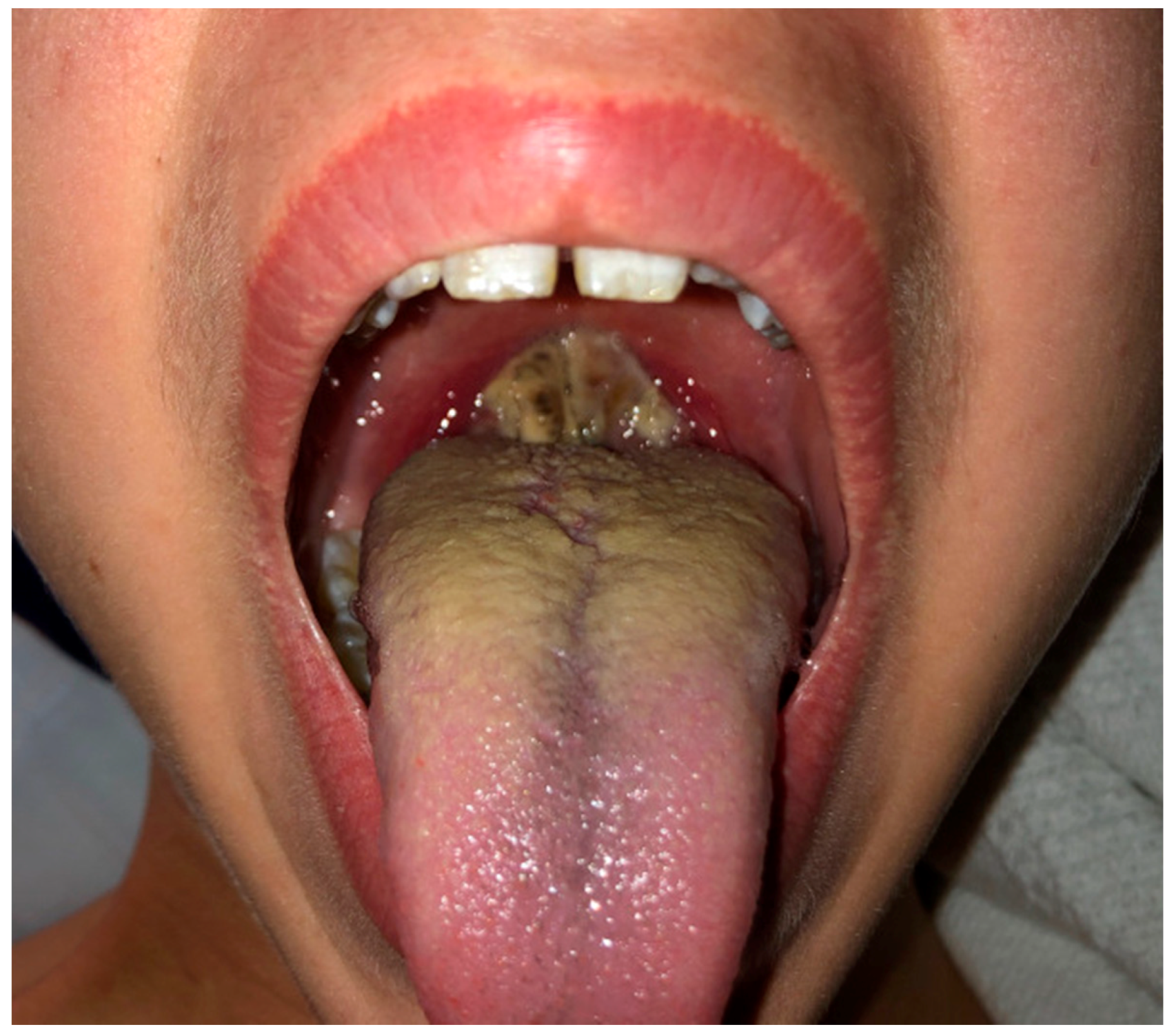 Medicines 07 00021 g001 Medicines 07 00021 g001