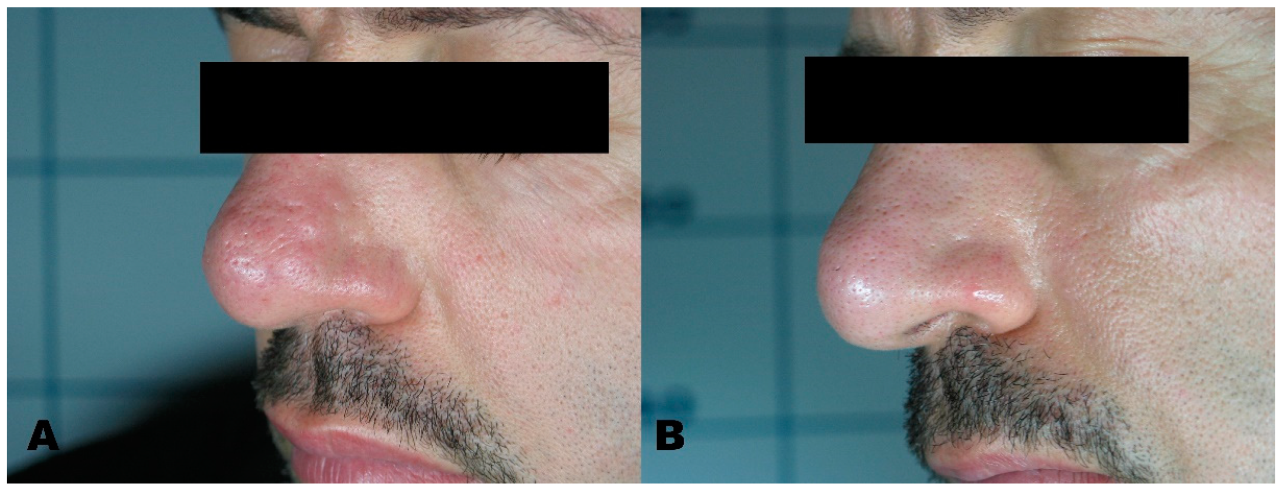 Medicines 08 00074 g003 550