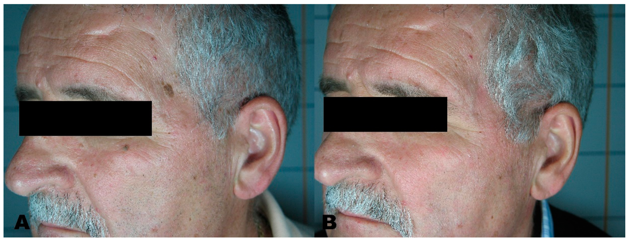 Medicines 08 00074 g007 550