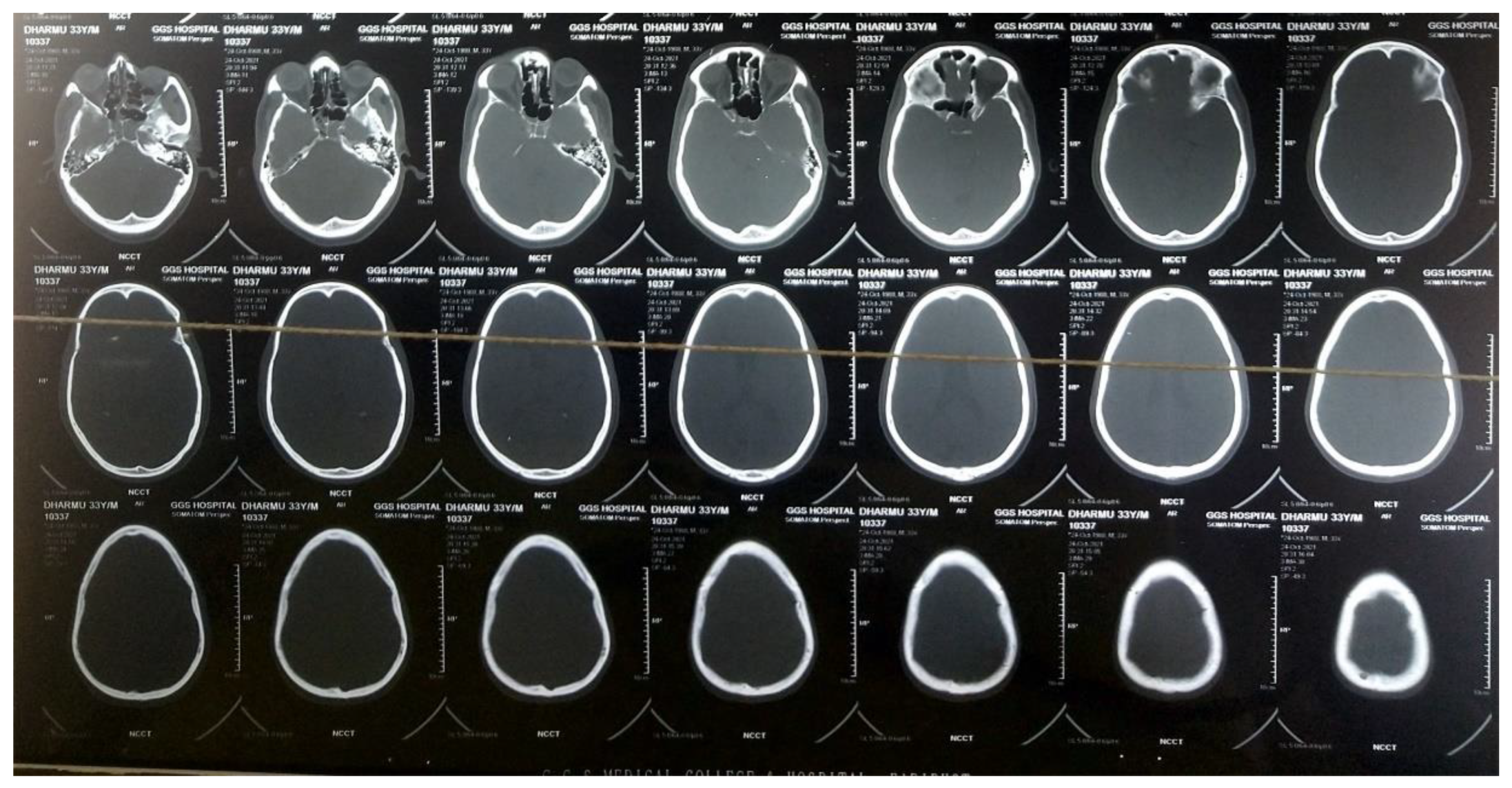 Medicines 09 00027 g001 550