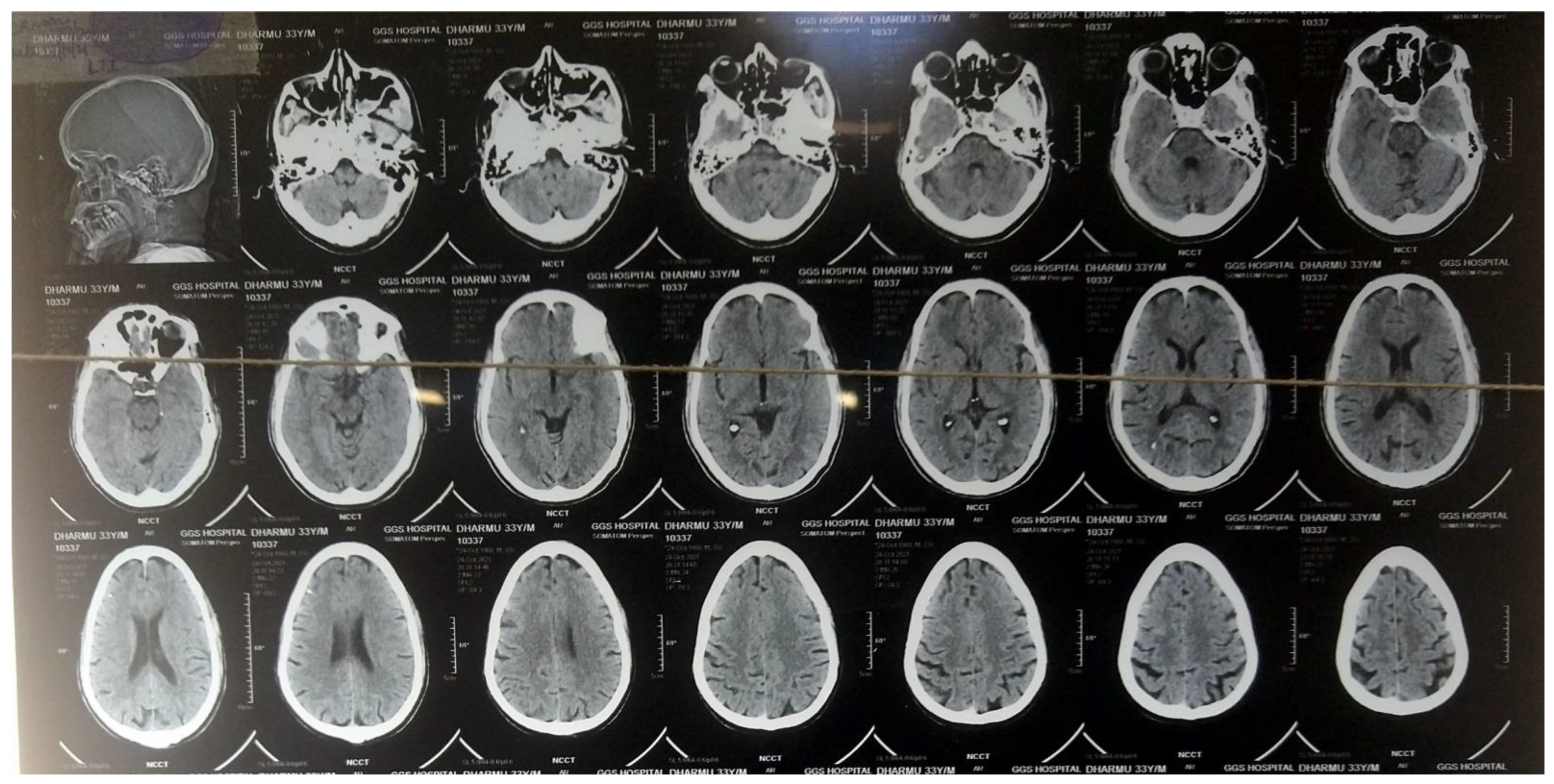 Medicines 09 00027 g003 550