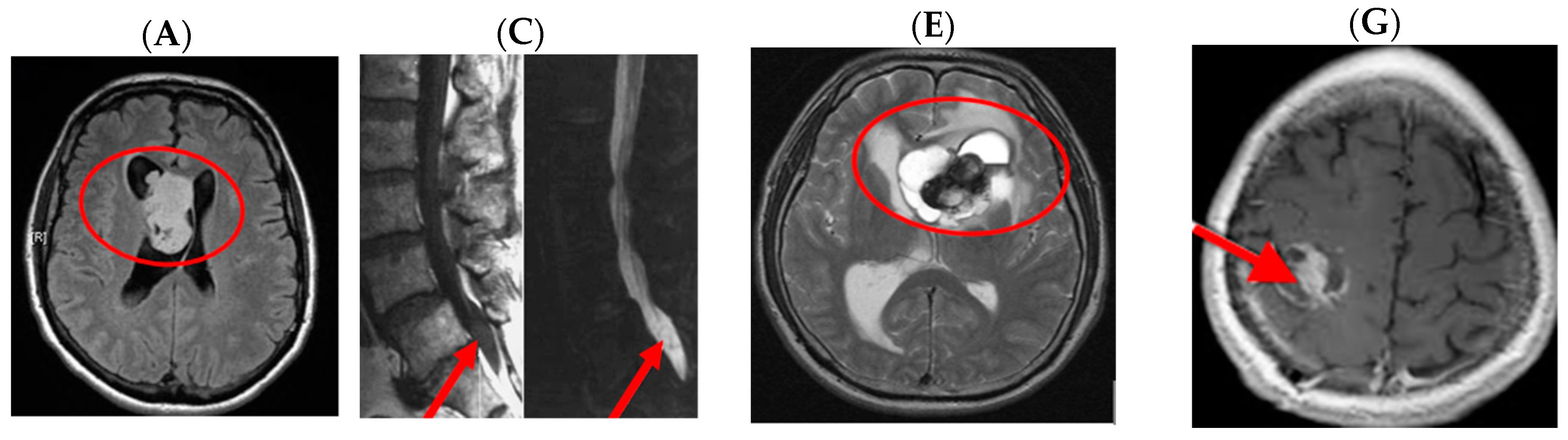 Medsci 05 00016 g008a