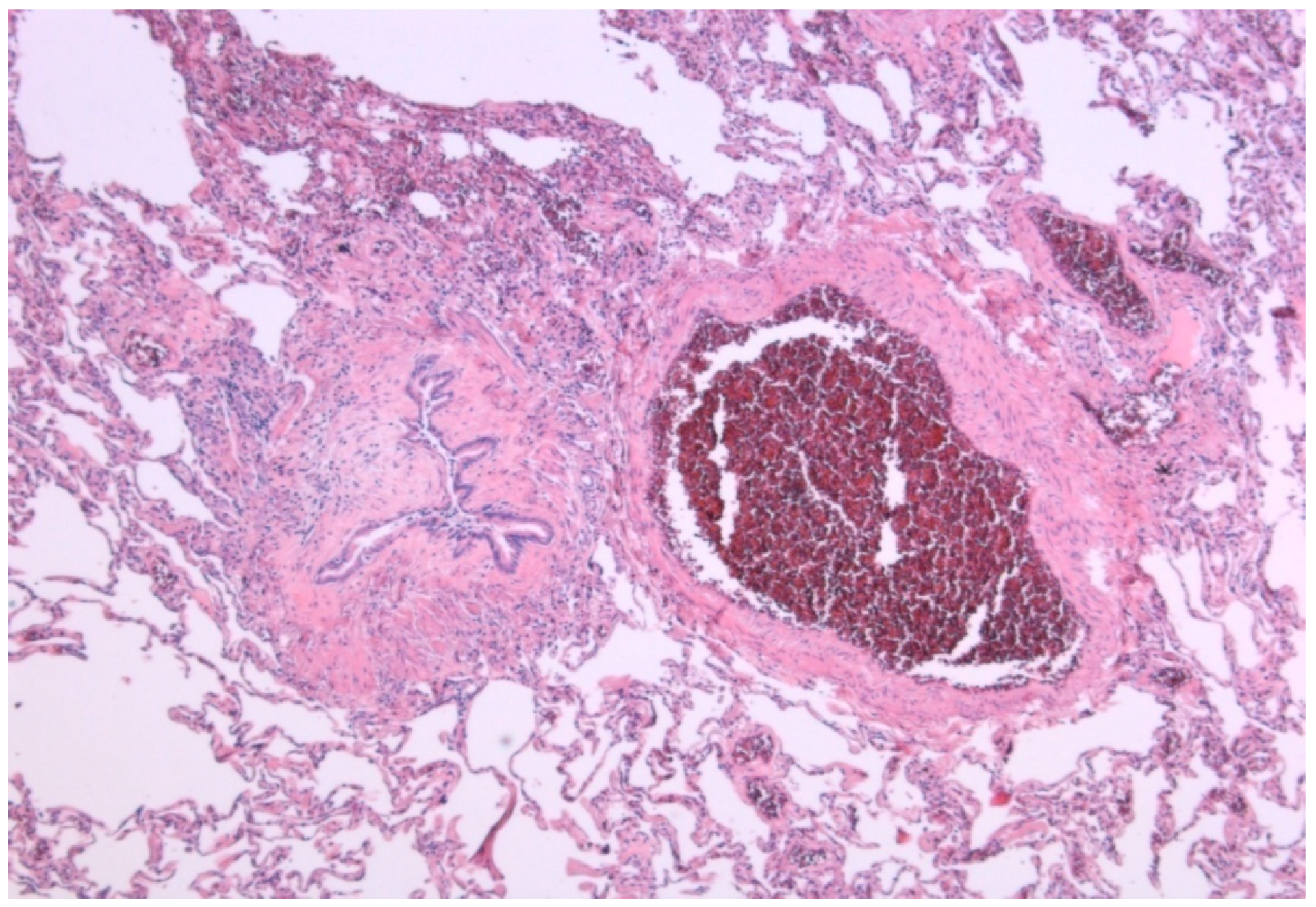 Medsci 06 00068 g002 Medsci 06 00068 g002