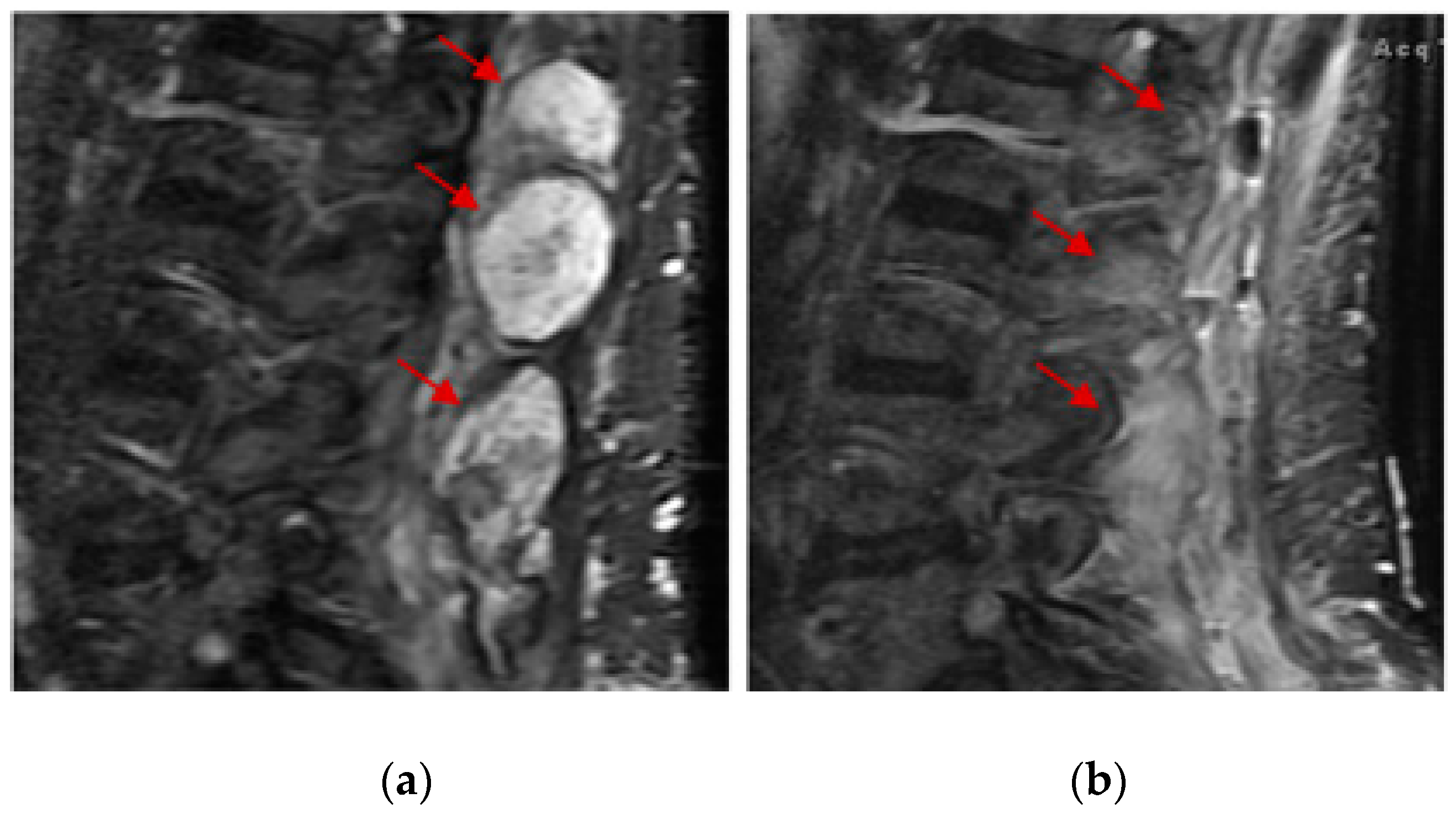 Medsci 07 00048 g003