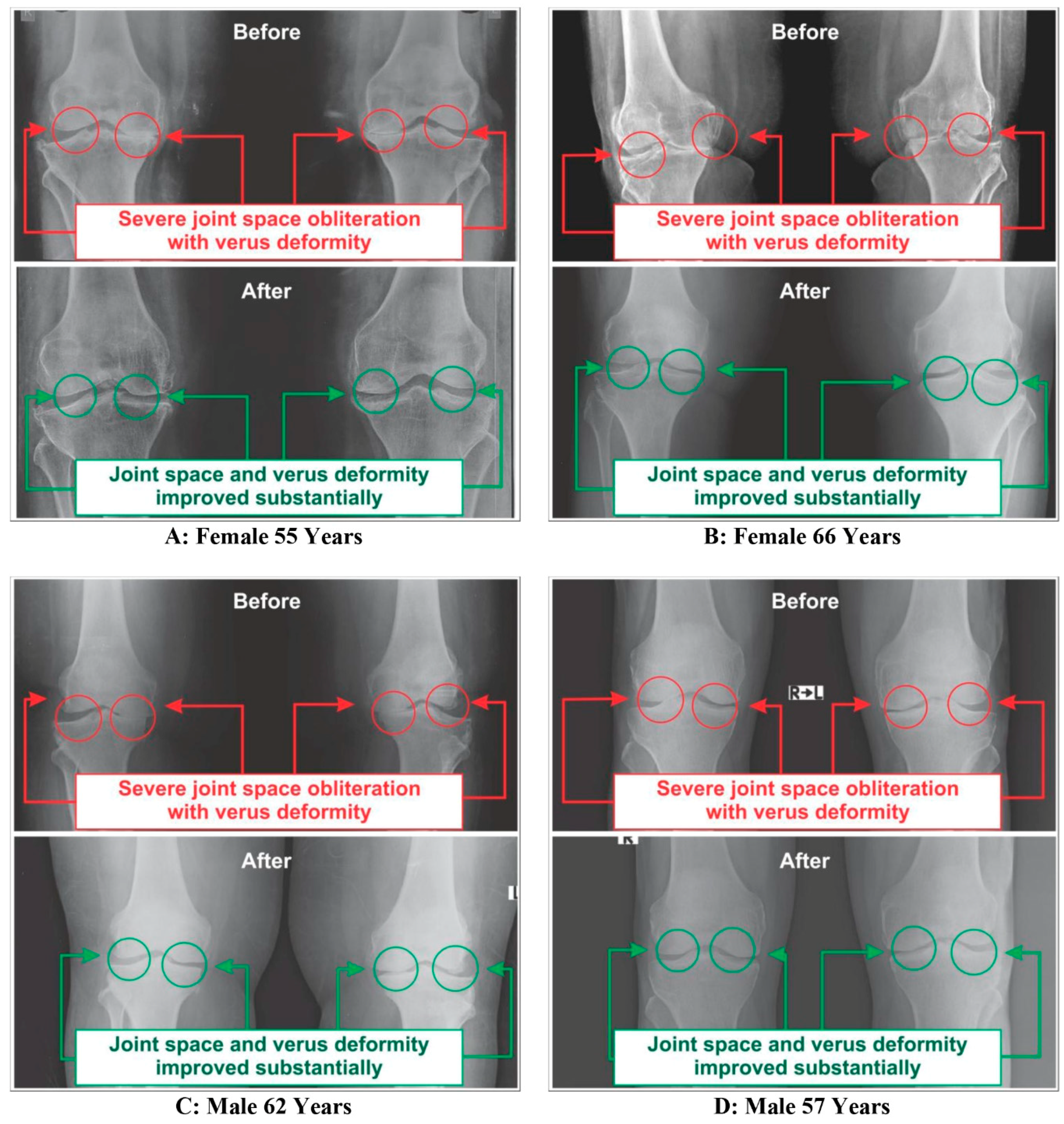 Medsci 07 00105 g011