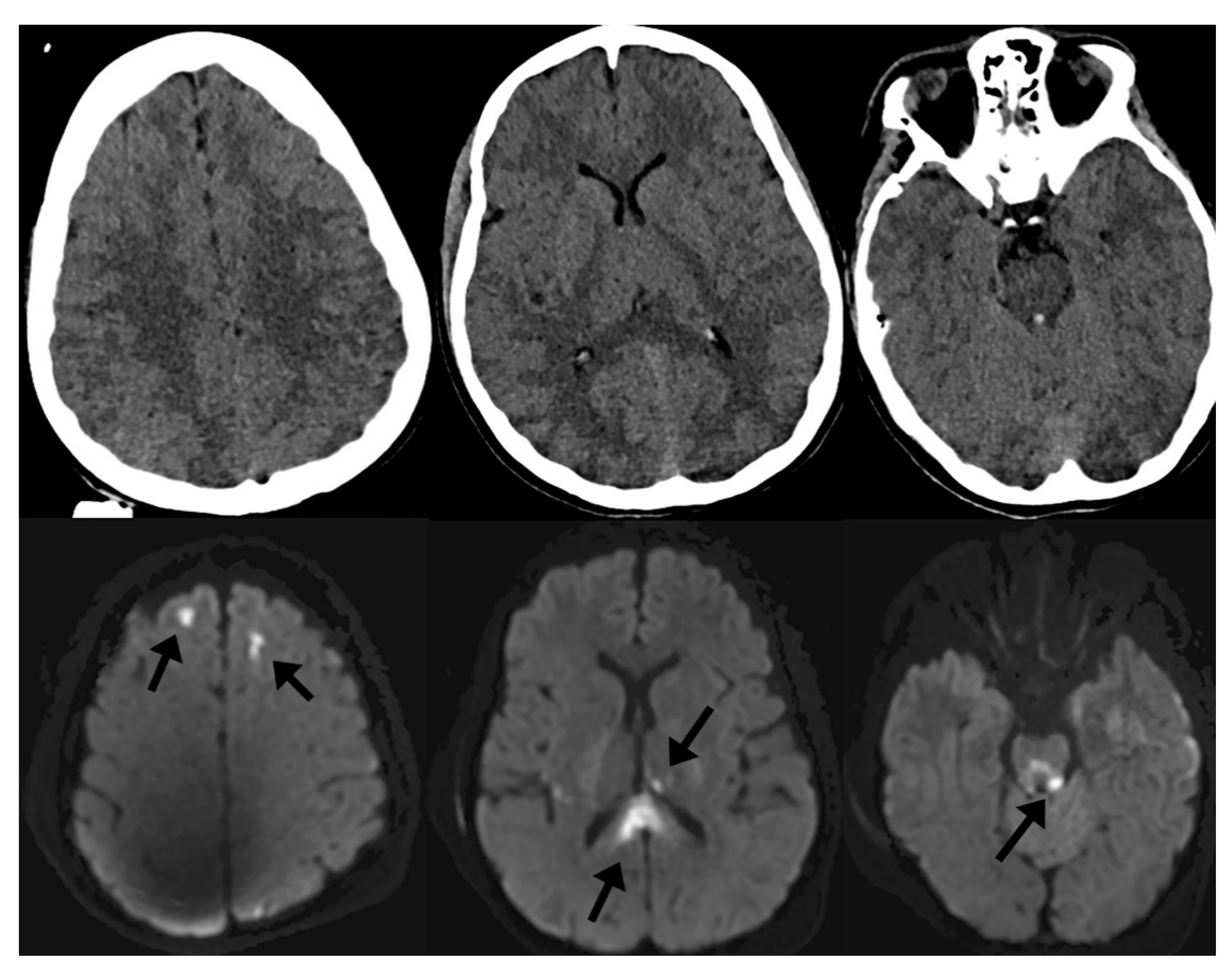 fMRI vs. SPECT Scan for the Brain