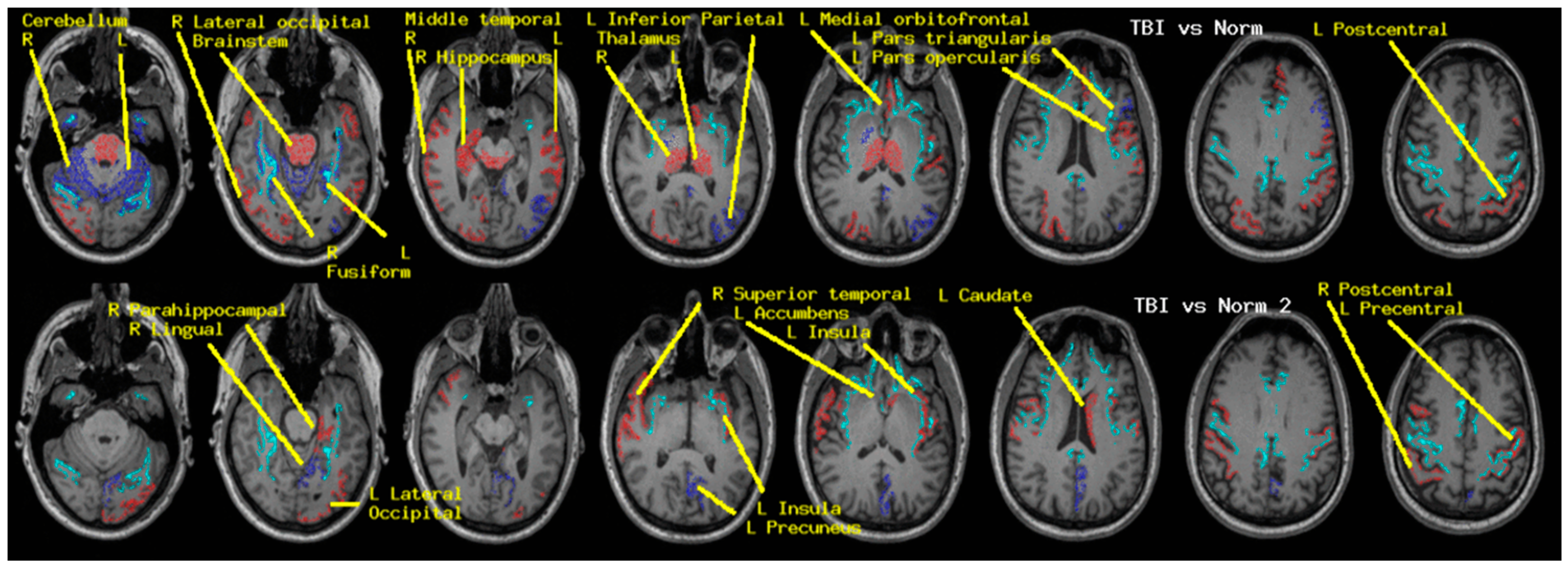 Medsci 09 00020 g003