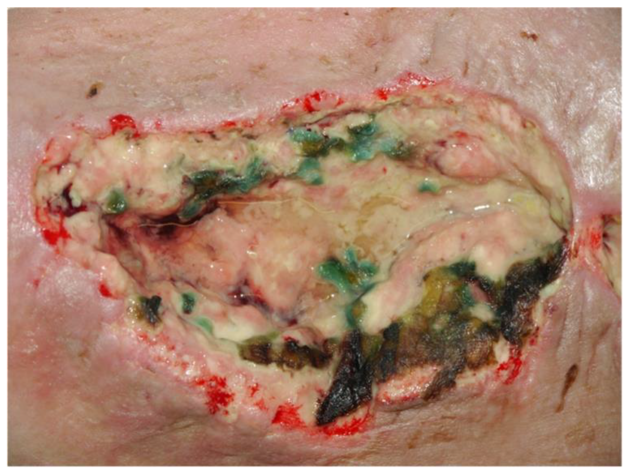 Medsci 09 00045 g002