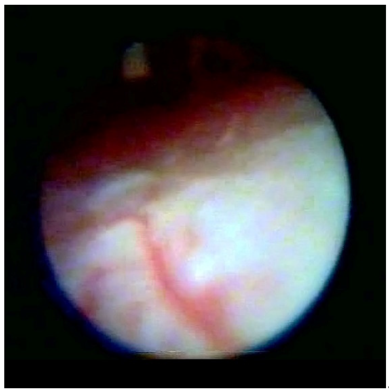 Medsci 10 00018 g001 550