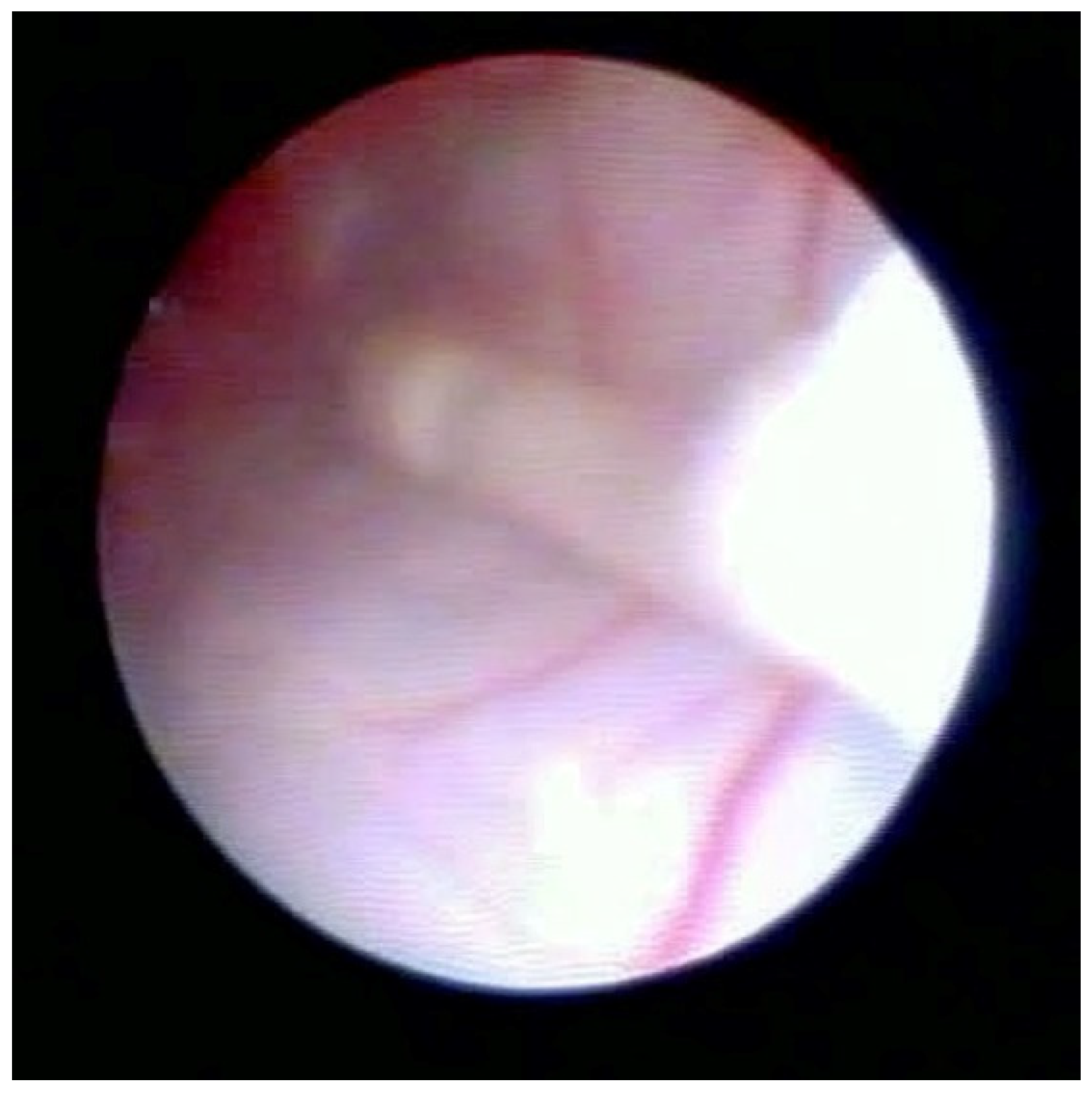 Medsci 10 00018 g003 550