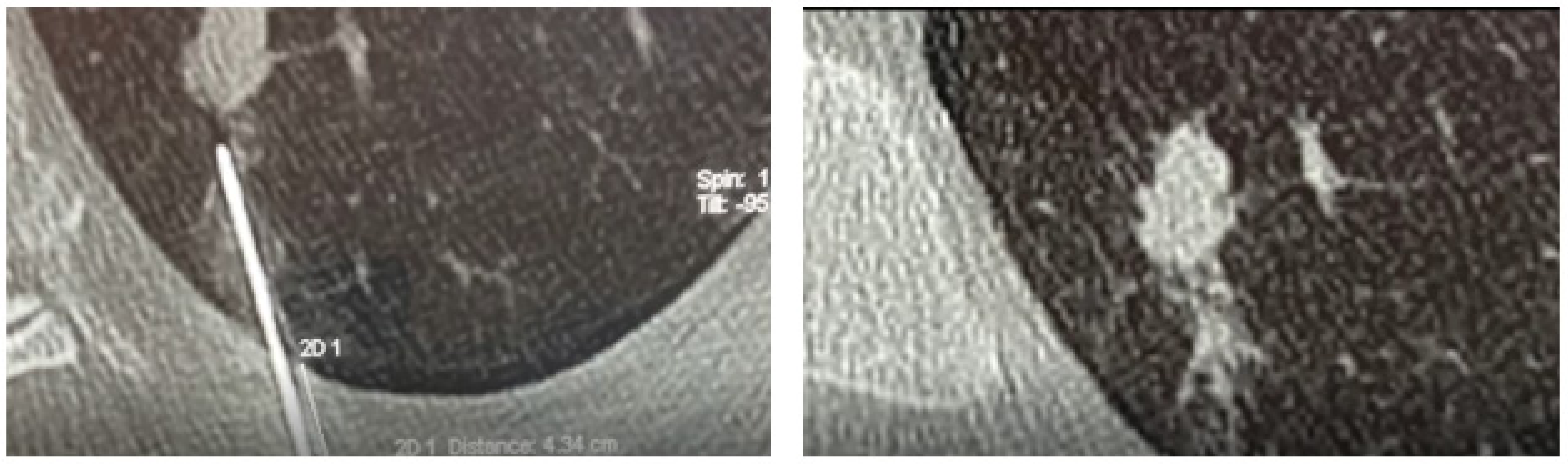 Medsci 10 00054 g002