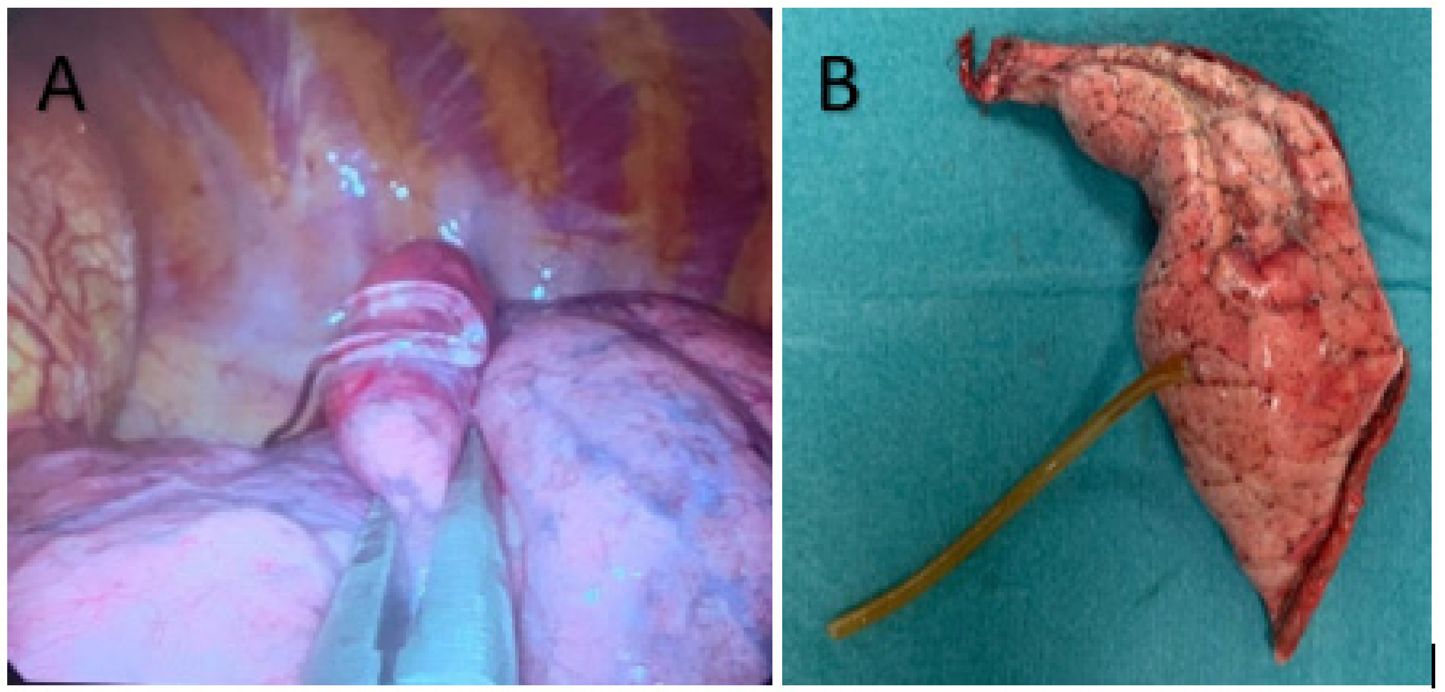 Medsci 10 00054 g003