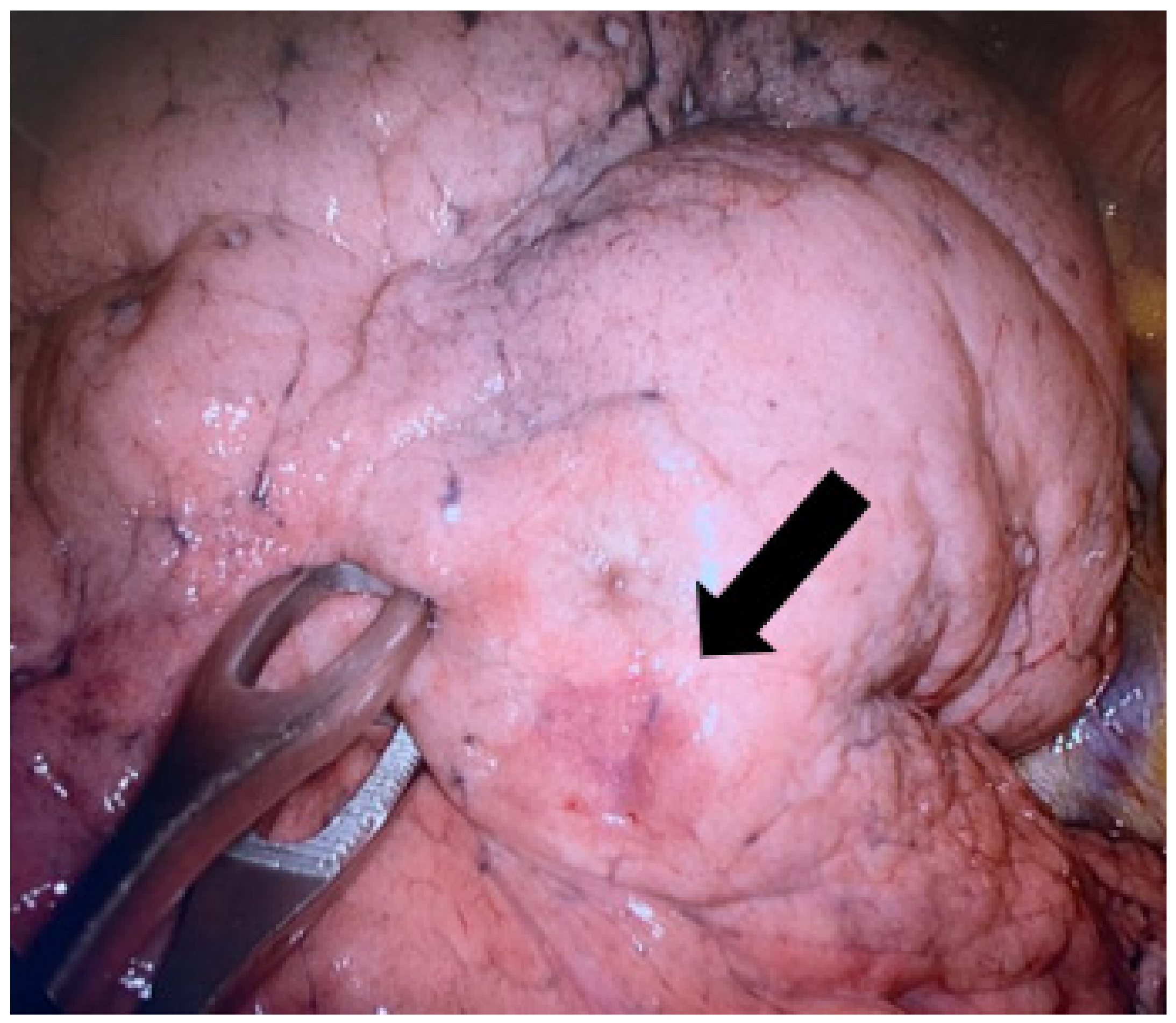 Medsci 10 00054 g004